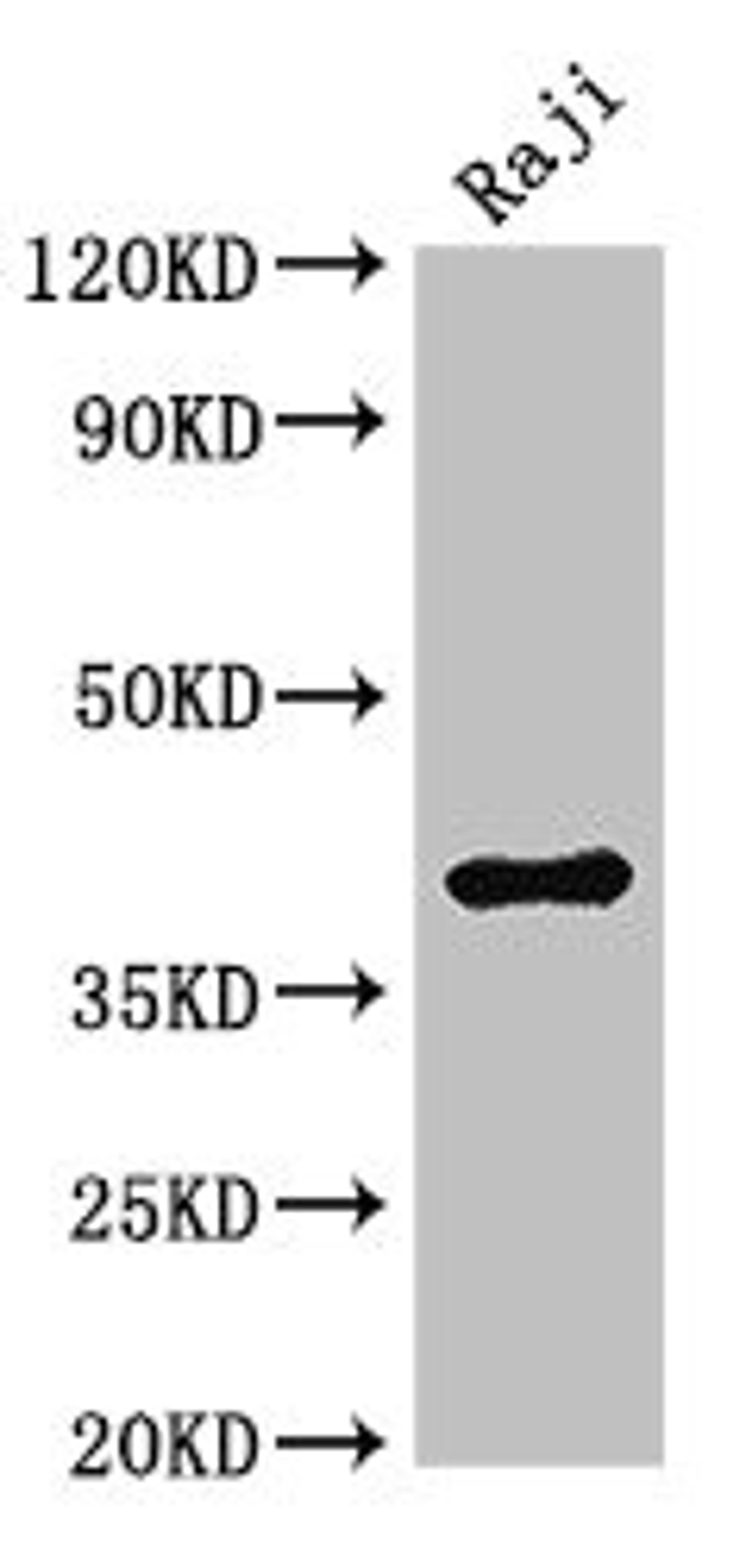 Western Blot. Positive WB detected in: Raji whole cell lysate. All lanes: HMBS antibody at 3µg/ml. Secondary. Goat polyclonal to rabbit IgG at 1/50000 dilution. Predicted band size: 40, 38, 35, 34 kDa. Observed band size: 40 kDa