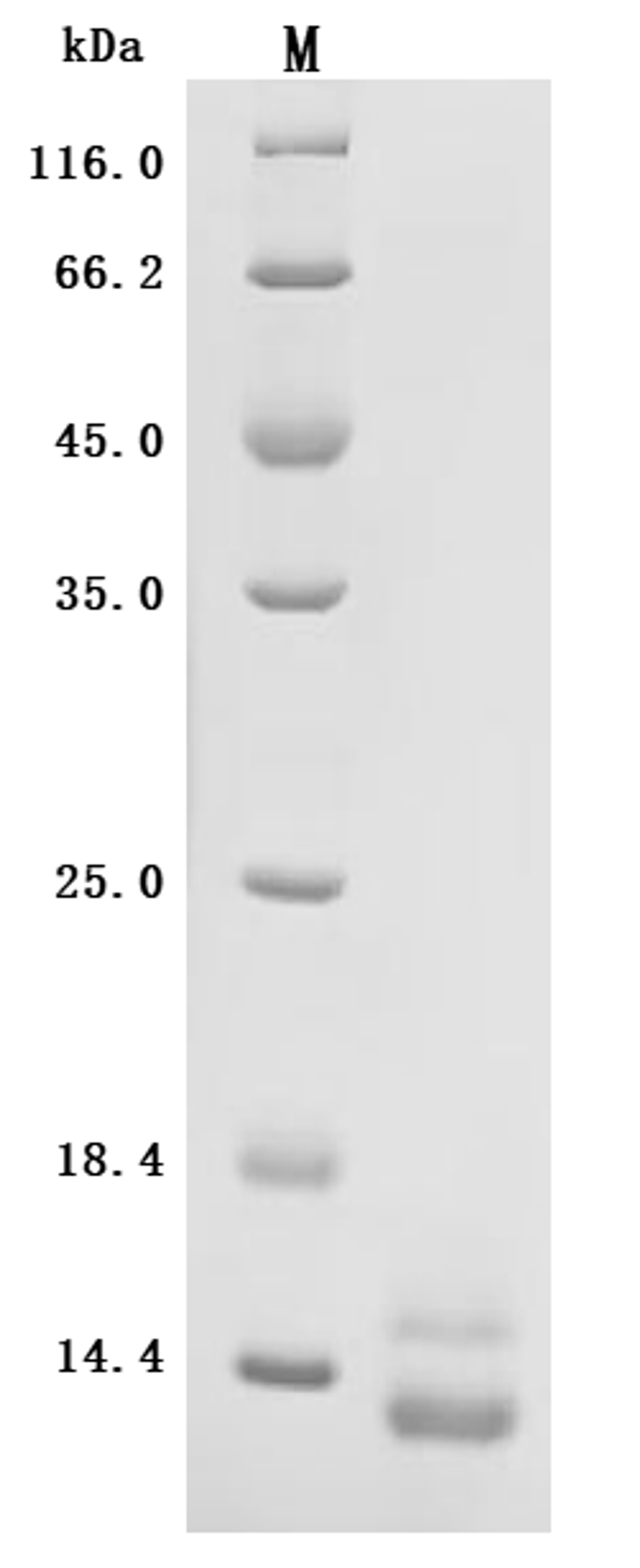 (Tris-Glycine gel) Discontinuous SDS-PAGE (reduced) with 5% enrichment gel and 15% separation gel.
