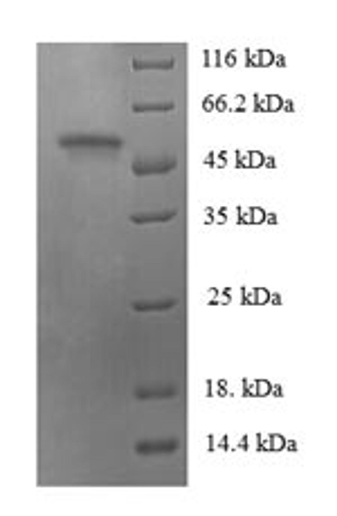 (Tris-Glycine gel) Discontinuous SDS-PAGE (reduced) with 5% enrichment gel and 15% separation gel.