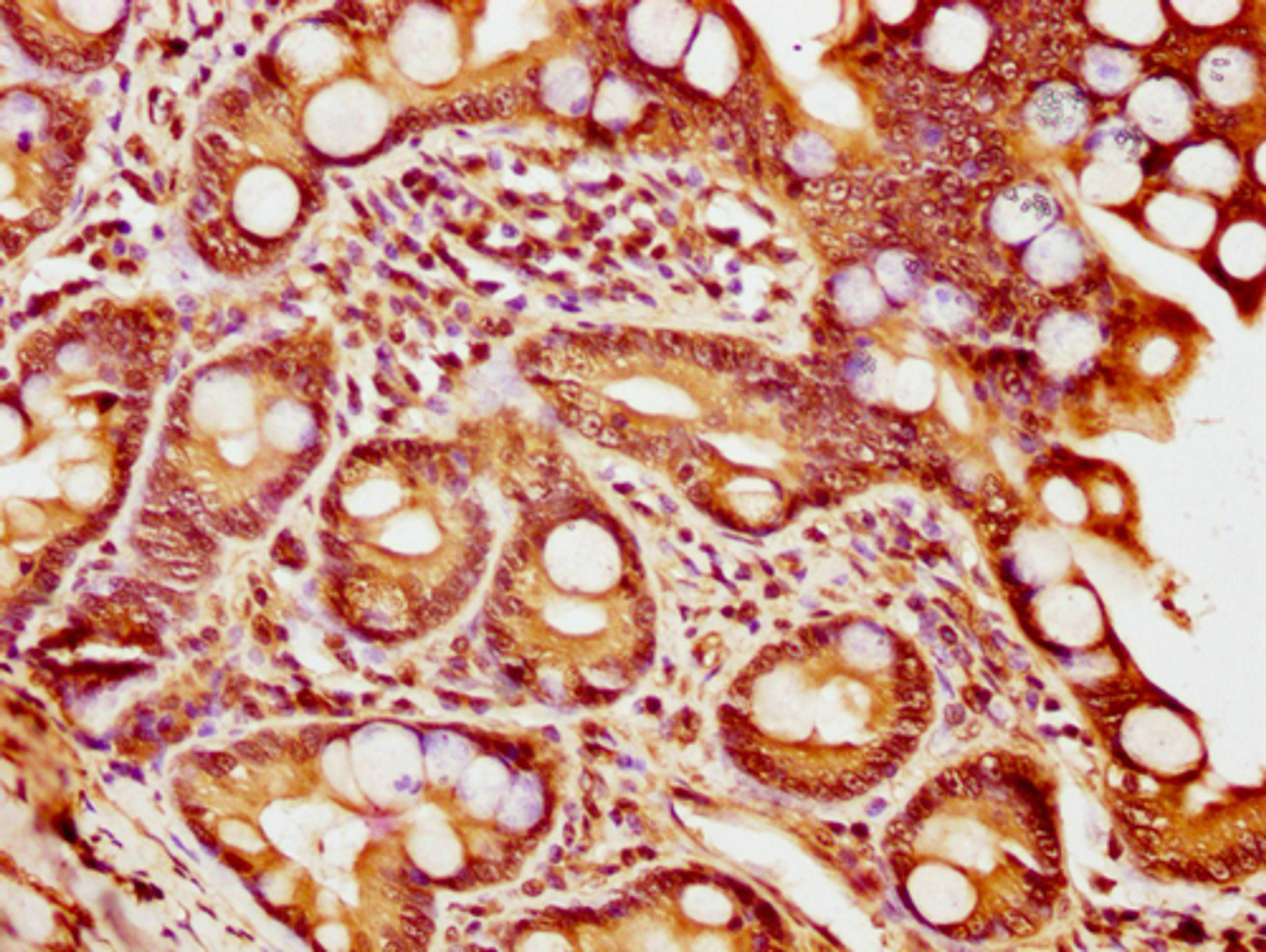 IHC image of CSB-PA010418PA56nsucHU diluted at 1:20 and staining in paraffin-embedded human small intestine tissue performed on a Leica BondTM system. After dewaxing and hydration, antigen retrieval was mediated by high pressure in a citrate buffer (pH 6.0). Section was blocked with 10% normal goat serum 30min at RT. Then primary antibody (1% BSA) was incubated at 4°C overnight. The primary is detected by a biotinylated secondary antibody and visualized using an HRP conjugated SP system.