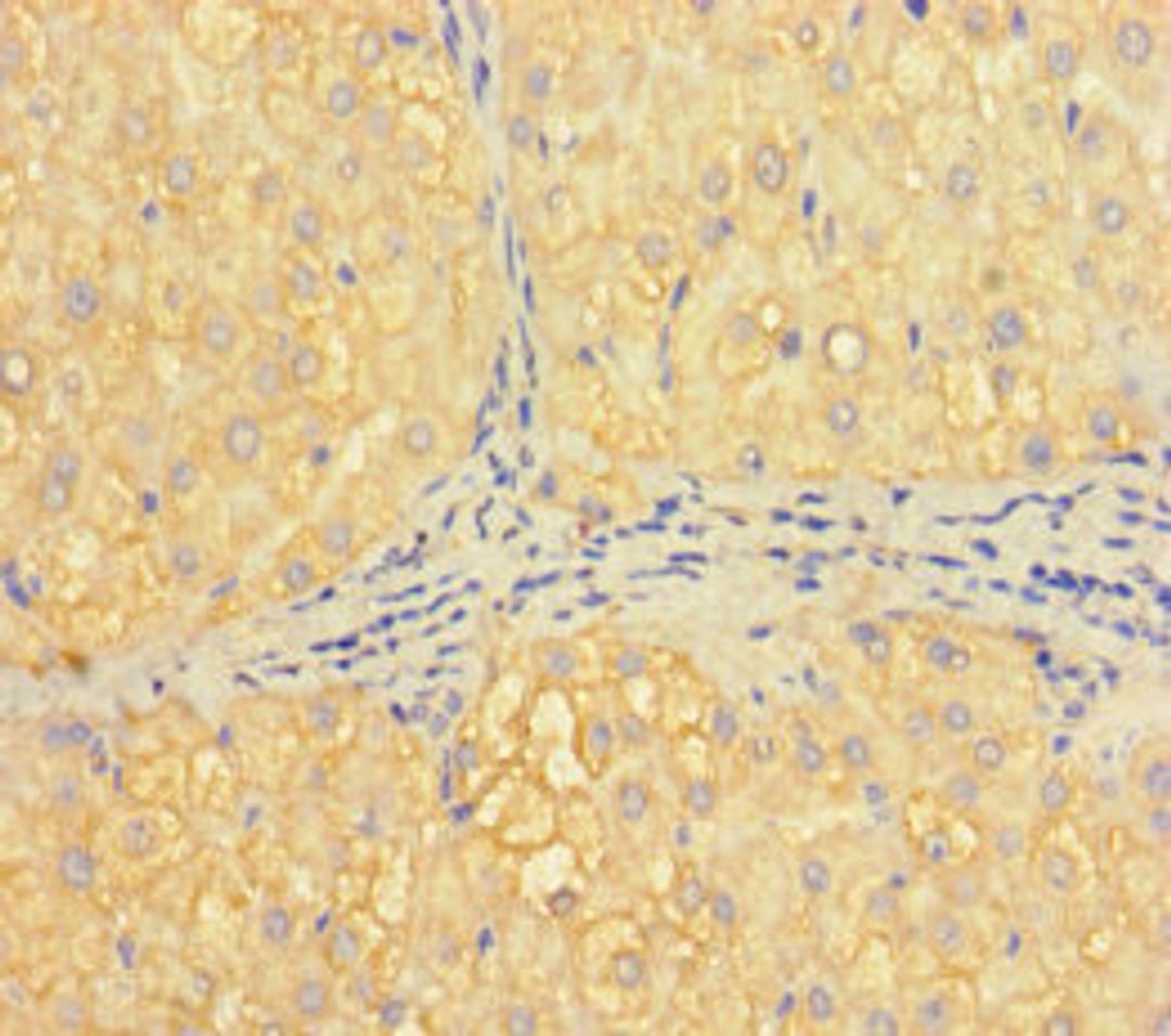 Immunohistochemistry of paraffin-embedded human liver tissue using CSB-PA010091LA01HU at dilution of 1:100