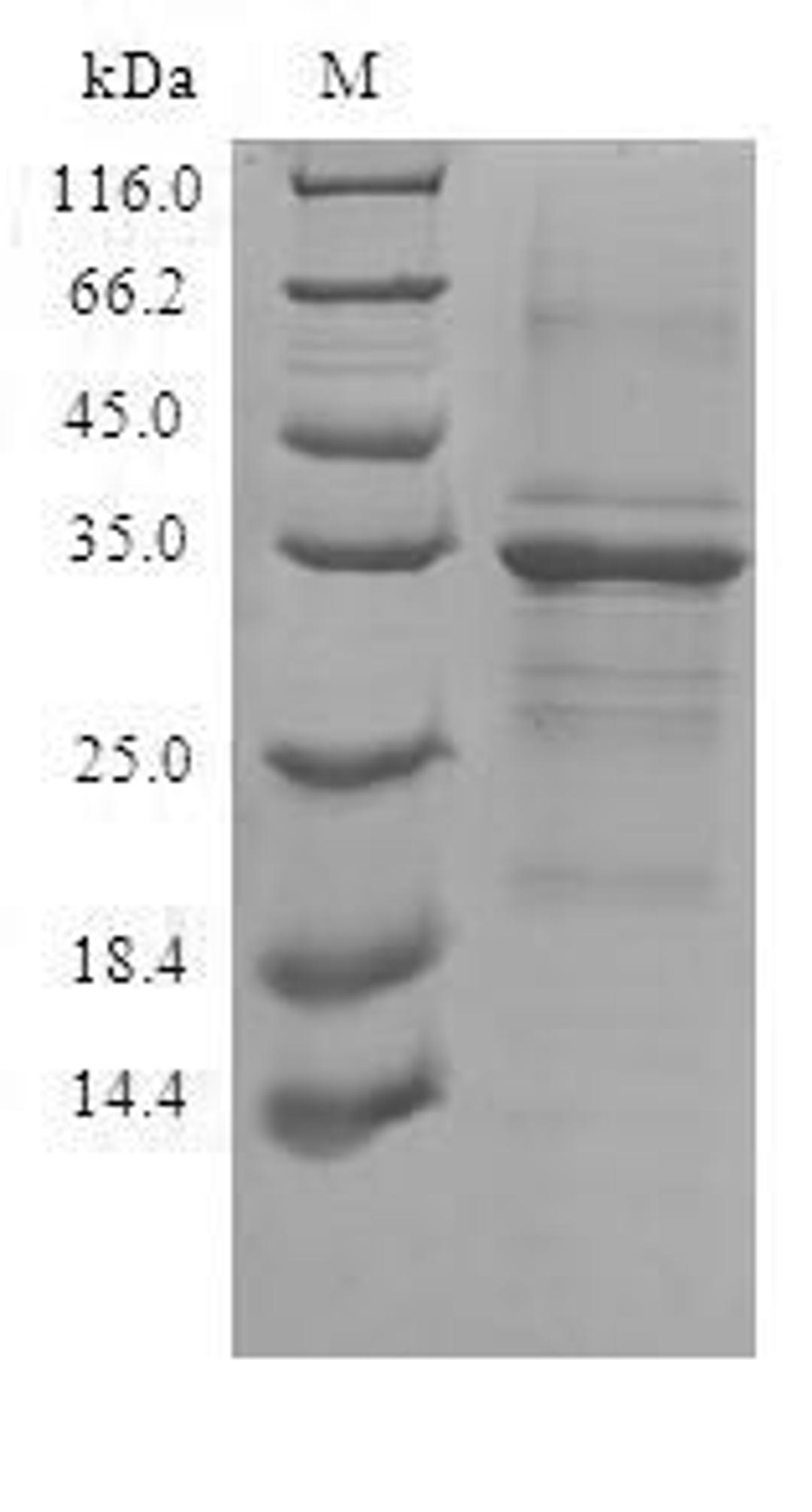 (Tris-Glycine gel) Discontinuous SDS-PAGE (reduced) with 5% enrichment gel and 15% separation gel.