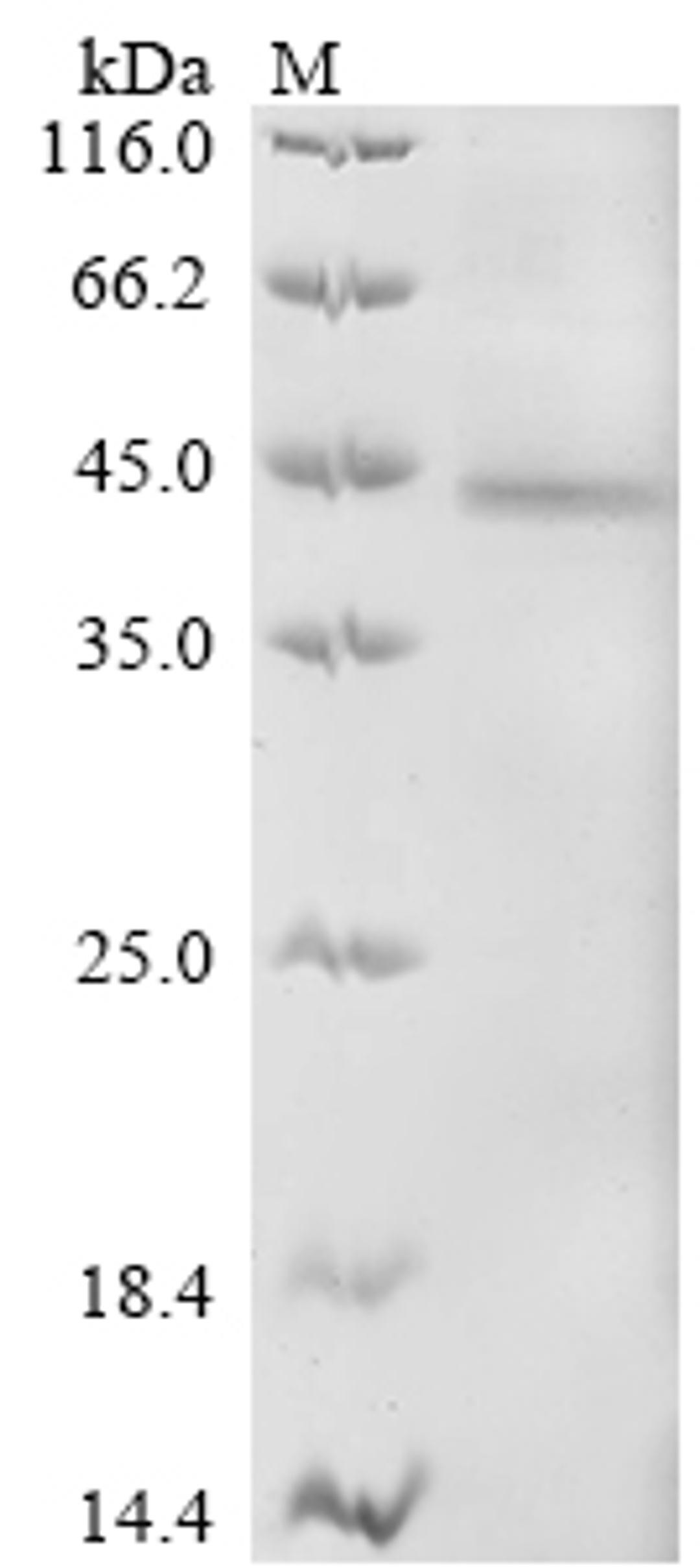 (Tris-Glycine gel) Discontinuous SDS-PAGE (reduced) with 5% enrichment gel and 15% separation gel.