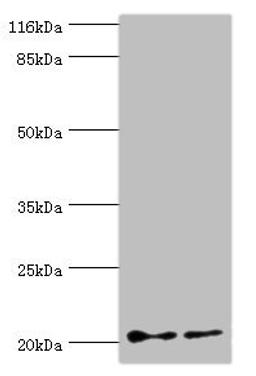 Western blot. All lanes: UBE2C antibody at 2µg/ml. Lane 1: Hela whole cell lysate. Lane 2: U87 whole cell lysate. Secondary. Goat polyclonal to rabbit IgG at 1/10000 dilution. Predicted band size: 20, 16, 17, 18 kDa. Observed band size: 20 kDa