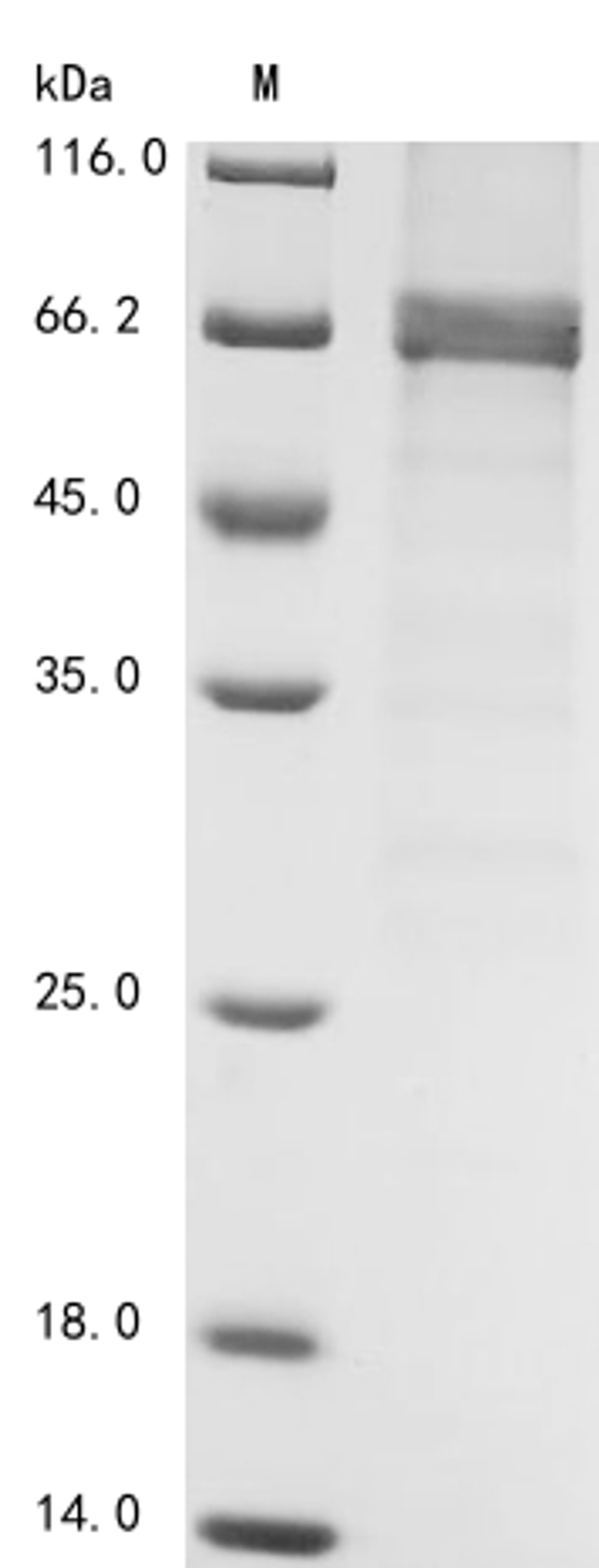 (Tris-Glycine gel) Discontinuous SDS-PAGE (reduced) with 5% enrichment gel and 15% separation gel.