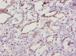 Immunohistochemistry of paraffin-embedded human kidney tissue using CSB-PA022397LA01MO at dilution of 1:10