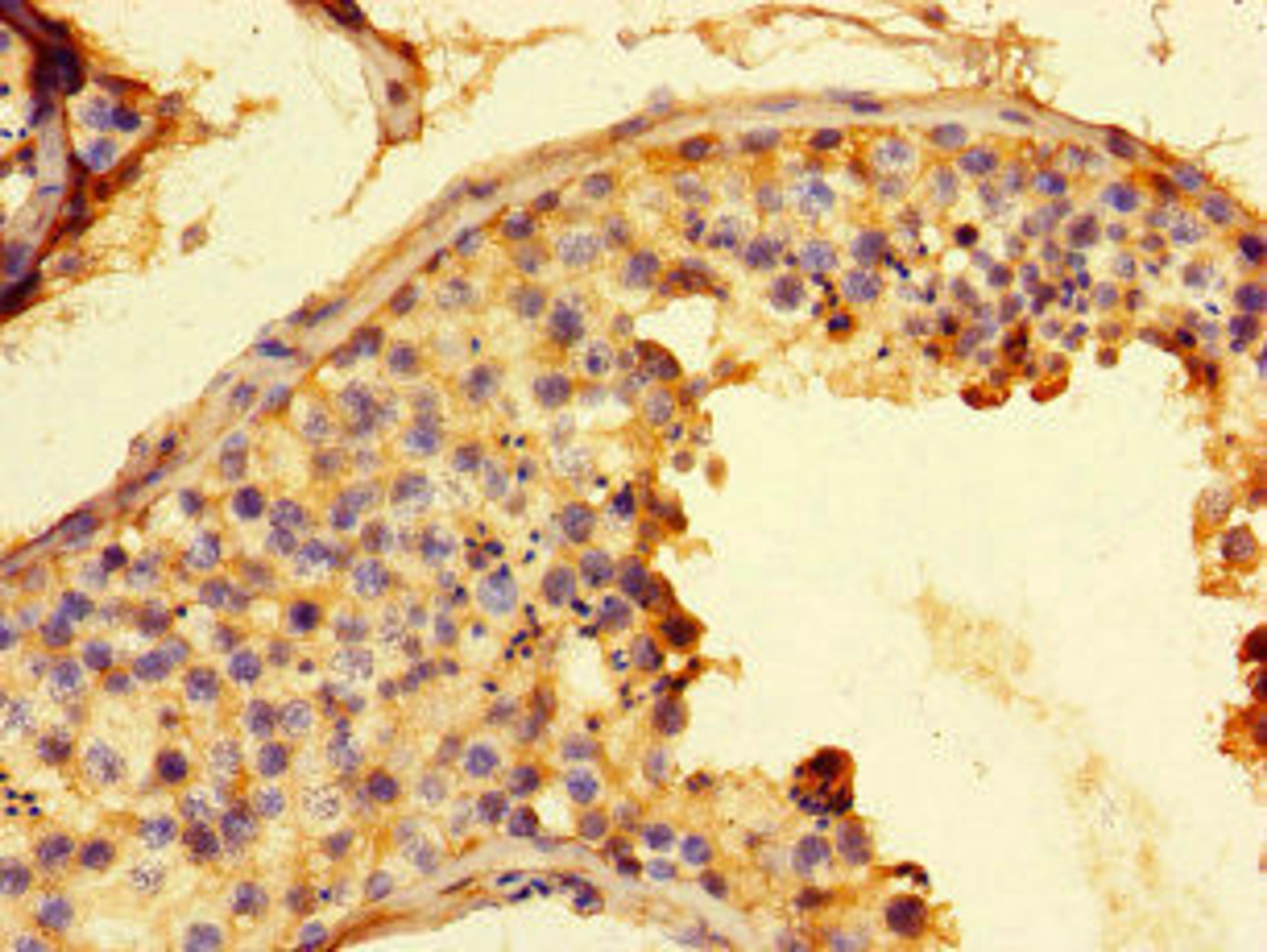 Immunohistochemistry of paraffin-embedded human testis tissue using CSB-PA009121LA01HU at dilution of 1:100