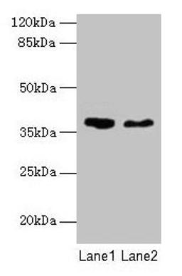 Western blot. All lanes: AGA antibody at 10µg/ml. Lane 1: 293T whole cell lysate. Lane 2: Mouse muscle tissue. Secondary. Goat polyclonal to rabbit IgG at 1/10000 dilution. Predicted band size: 38 kDa. Observed band size: 38 kDa