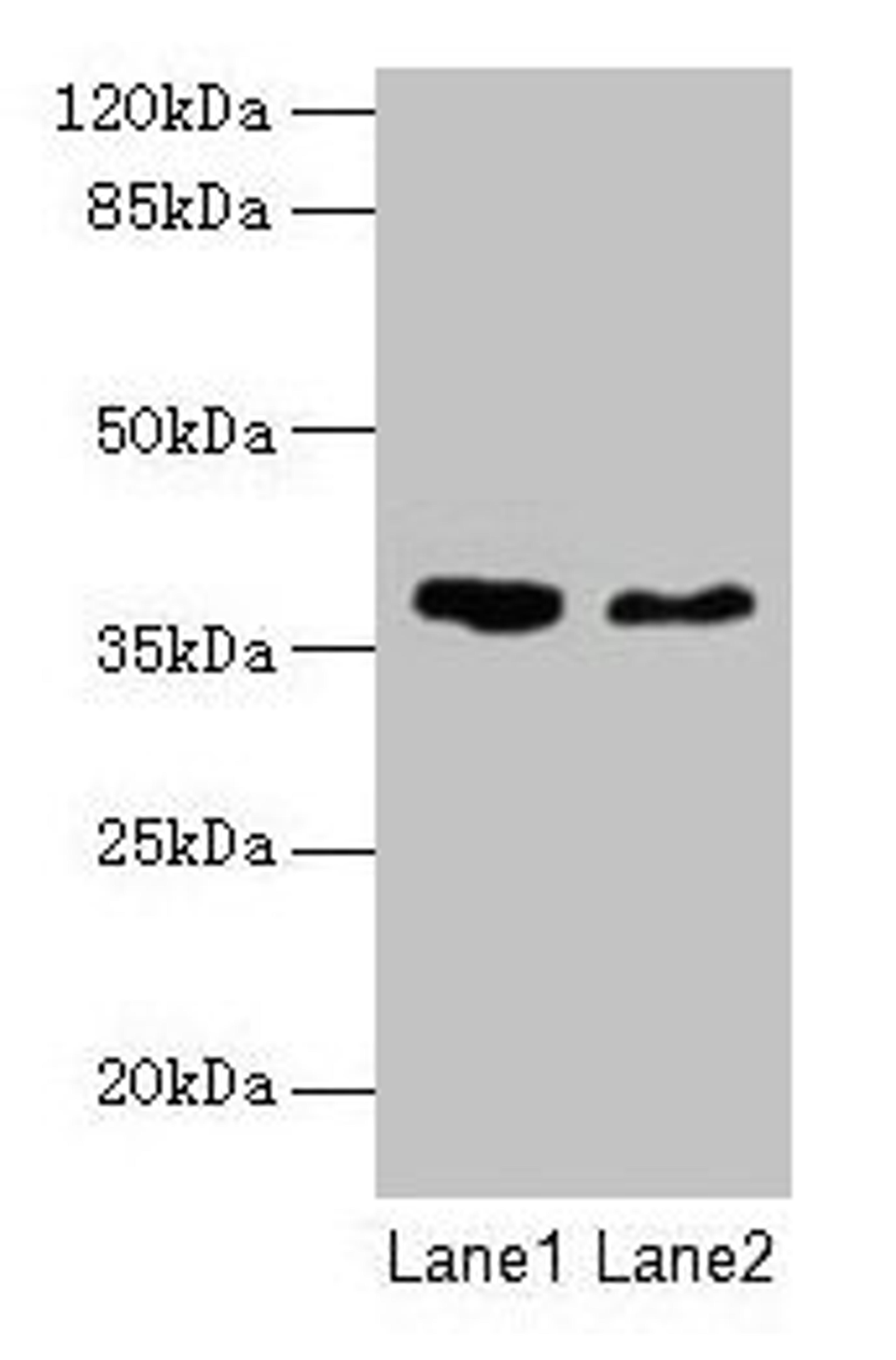 Western blot. All lanes: AGA antibody at 10µg/ml. Lane 1: 293T whole cell lysate. Lane 2: Mouse muscle tissue. Secondary. Goat polyclonal to rabbit IgG at 1/10000 dilution. Predicted band size: 38 kDa. Observed band size: 38 kDa