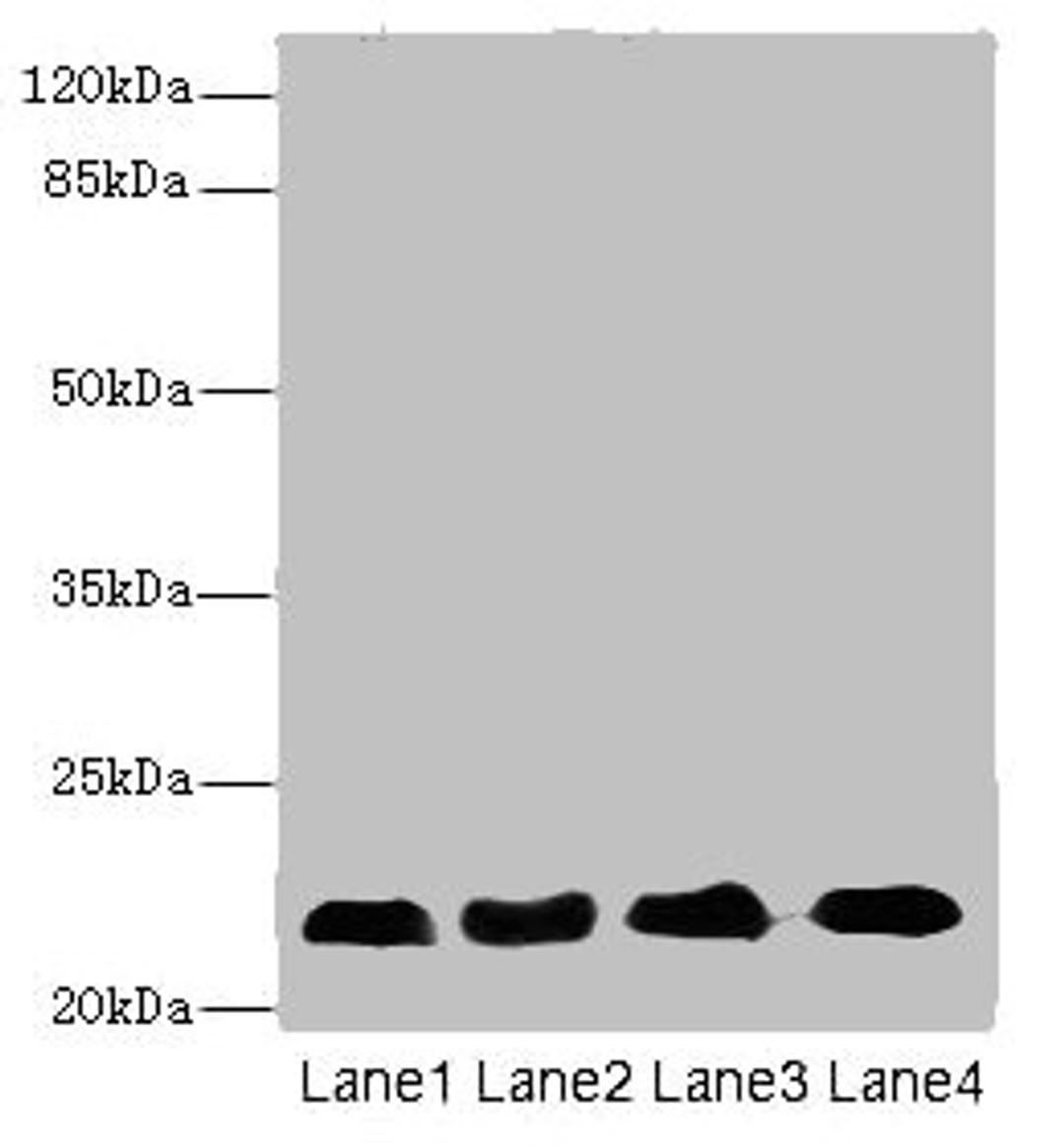 Western blot. All lanes: CRIP2 antibody at 5.93µg/ml. Lane 1: Rat heart tissue. Lane 2: Mouse lung tissue. Lane 3: Hela whole cell lysate. Lane 4: MCF-7 whole cell lysate. Secondary. Goat polyclonal to rabbit IgG at 1/10000 dilution. Predicted band size: 23, 31 kDa. Observed band size: 23 kDa