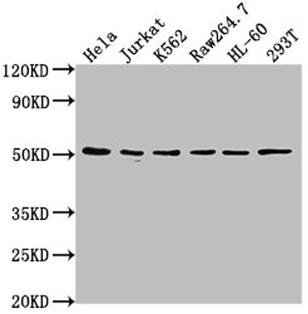 Western Blot. Positive WB detected in: Hela whole cell lysate, Jurkat whole cell lysate, K562 whole cell lysate, Raw264.7 whole cell lysate, HL-60 whole cell lysate, 293T whole cell lysate. All lanes: CSK antibody at 1:2000. Secondary. Goat polyclonal to rabbit IgG at 1/50000 dilution. Predicted band size: 51 kDa. Observed band size: 51 kDa. 