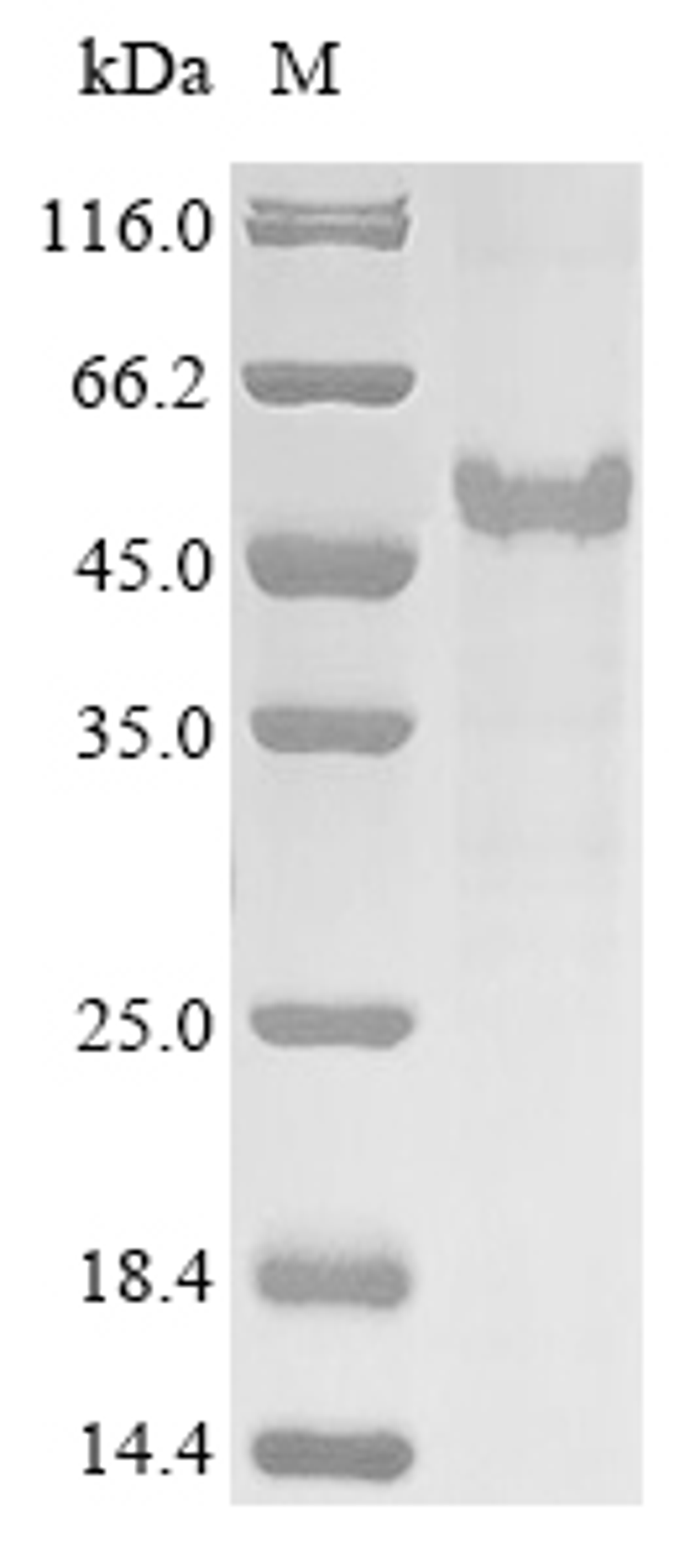 (Tris-Glycine gel) Discontinuous SDS-PAGE (reduced) with 5% enrichment gel and 15% separation gel.