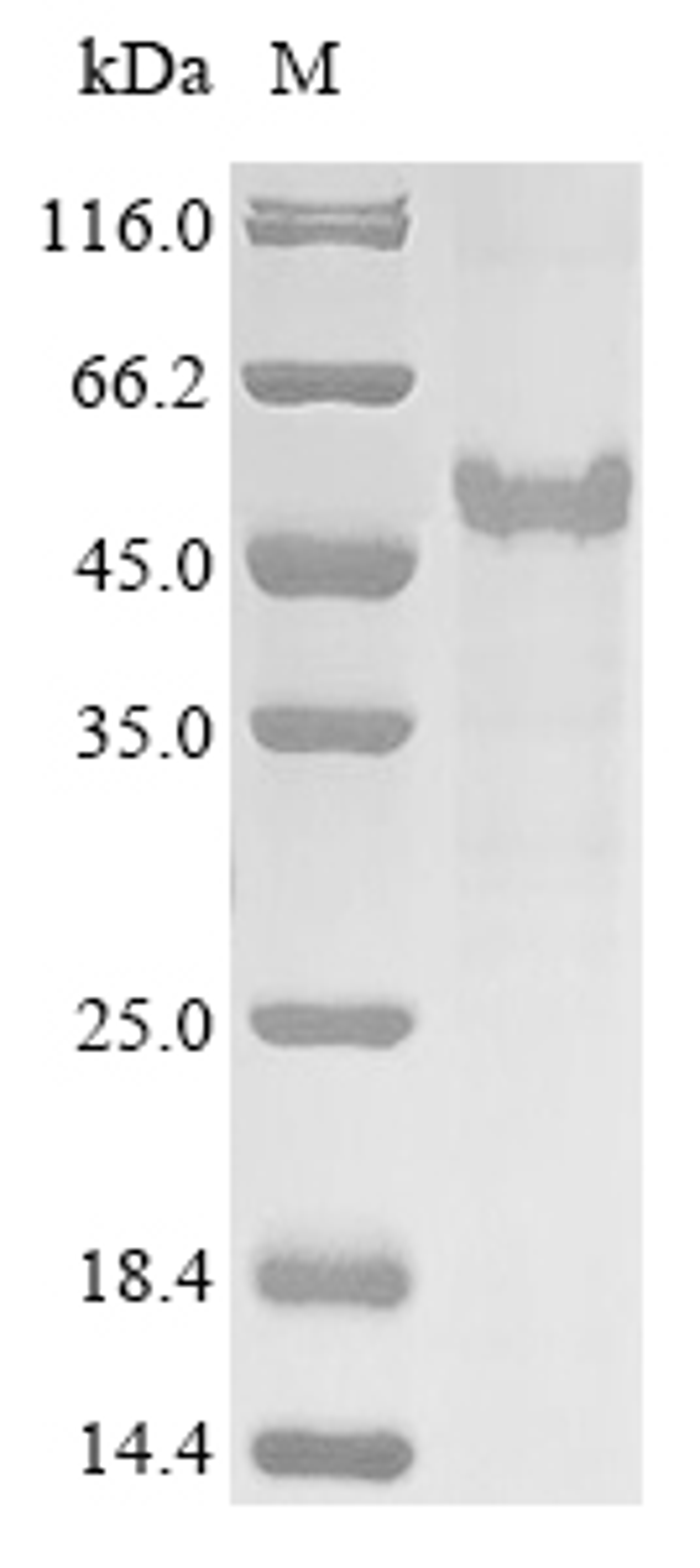 (Tris-Glycine gel) Discontinuous SDS-PAGE (reduced) with 5% enrichment gel and 15% separation gel.
