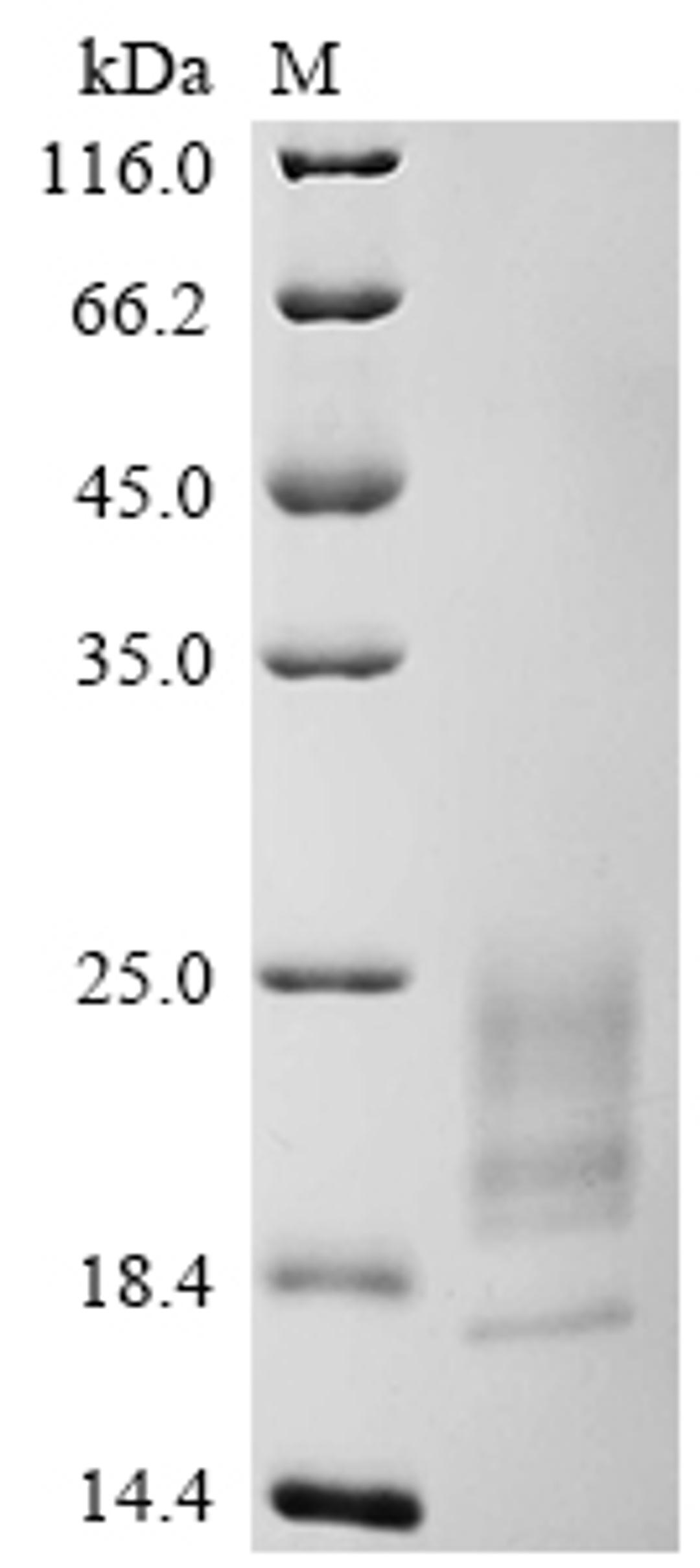 (Tris-Glycine gel) Discontinuous SDS-PAGE (reduced) with 5% enrichment gel and 15% separation gel.