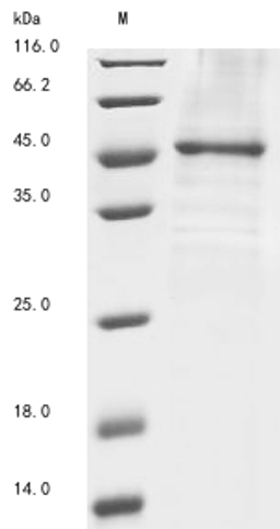 (Tris-Glycine gel) Discontinuous SDS-PAGE (reduced) with 5% enrichment gel and 15% separation gel.