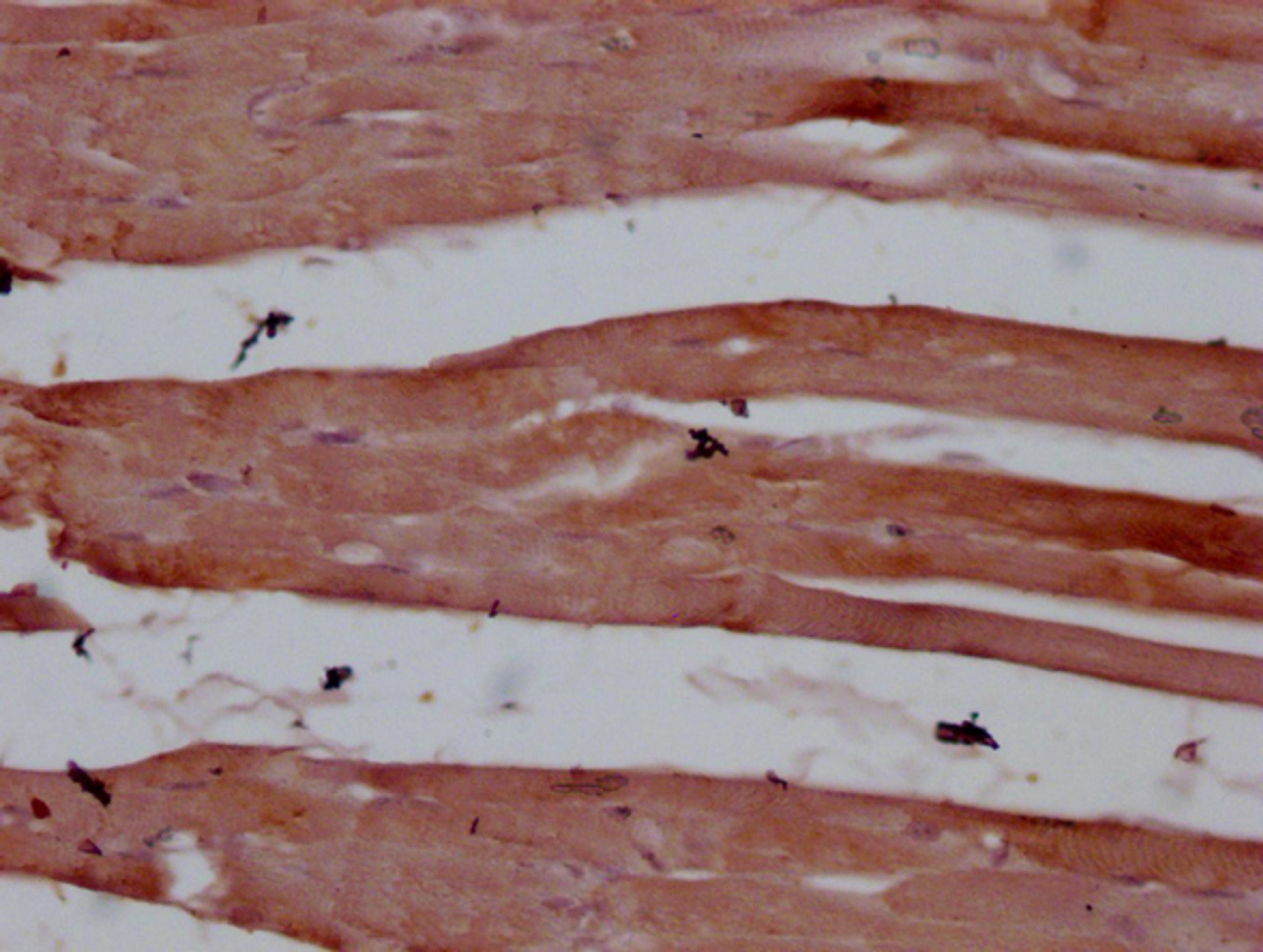 IHC image of CSB-MA830329 diluted at 1:100 and staining in paraffin-embedded human skeletal muscle tissue performed on a Leica BondTM system. After dewaxing and hydration, antigen retrieval was mediated by high pressure in a citrate buffer (pH 6.0). Section was blocked with 10% normal goat serum 30min at RT. Then primary antibody (1% BSA) was incubated at 4°C overnight. The primary is detected by a Goat anti-mouse IgG polymer labeled by HRP and visualized using 0.05% DAB.