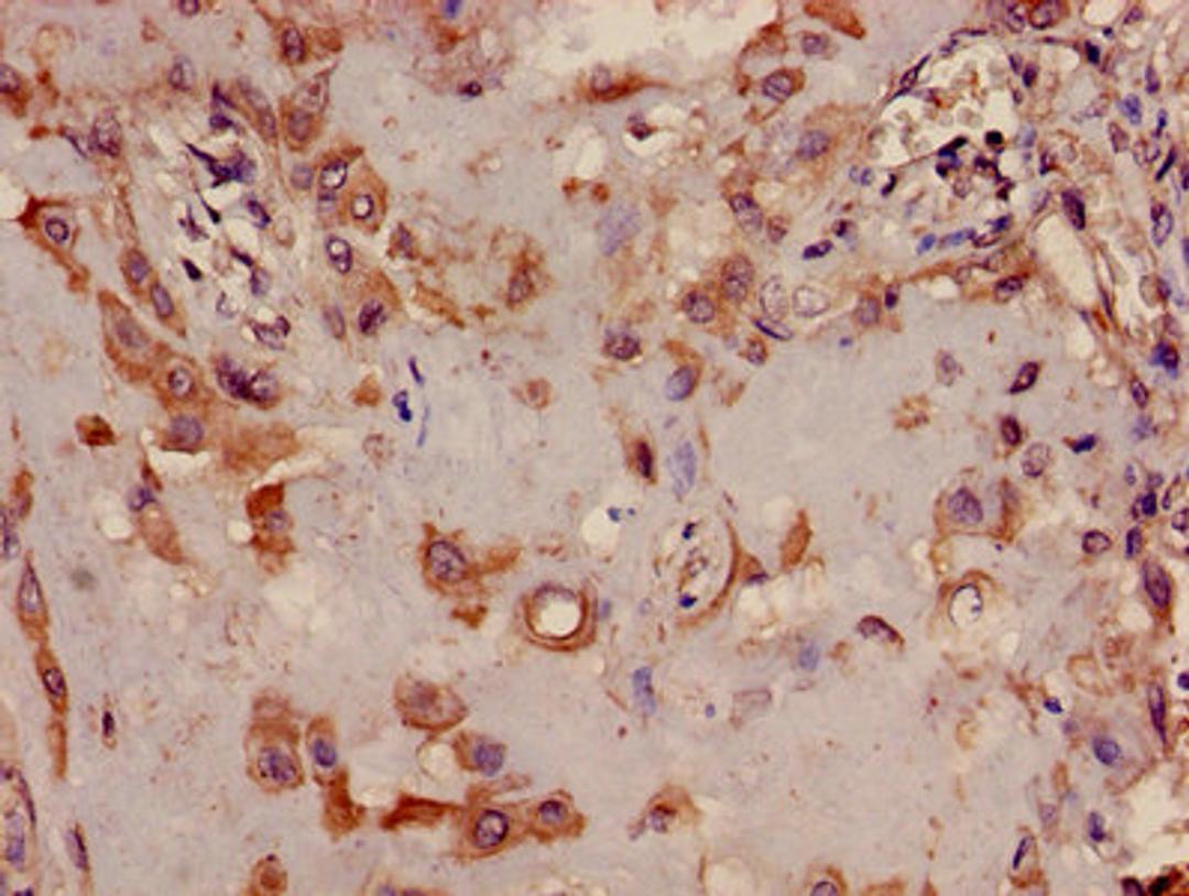 Immunohistochemistry of paraffin-embedded human placenta tissue using CSB-PA838778LA01HU at dilution of 1:100