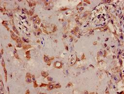 Immunohistochemistry of paraffin-embedded human placenta tissue using CSB-PA838778LA01HU at dilution of 1:100