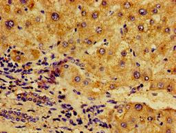 Immunohistochemistry of paraffin-embedded human liver tissue using CSB-PA10449A0Rb at dilution of 1:100