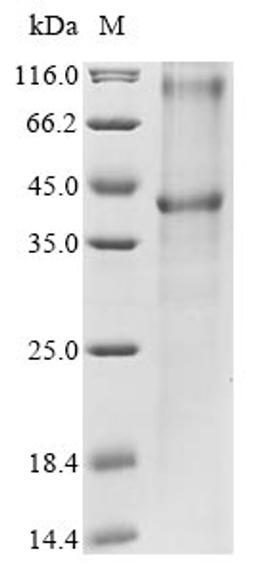 (Tris-Glycine gel) Discontinuous SDS-PAGE (reduced) with 5% enrichment gel and 15% separation gel.