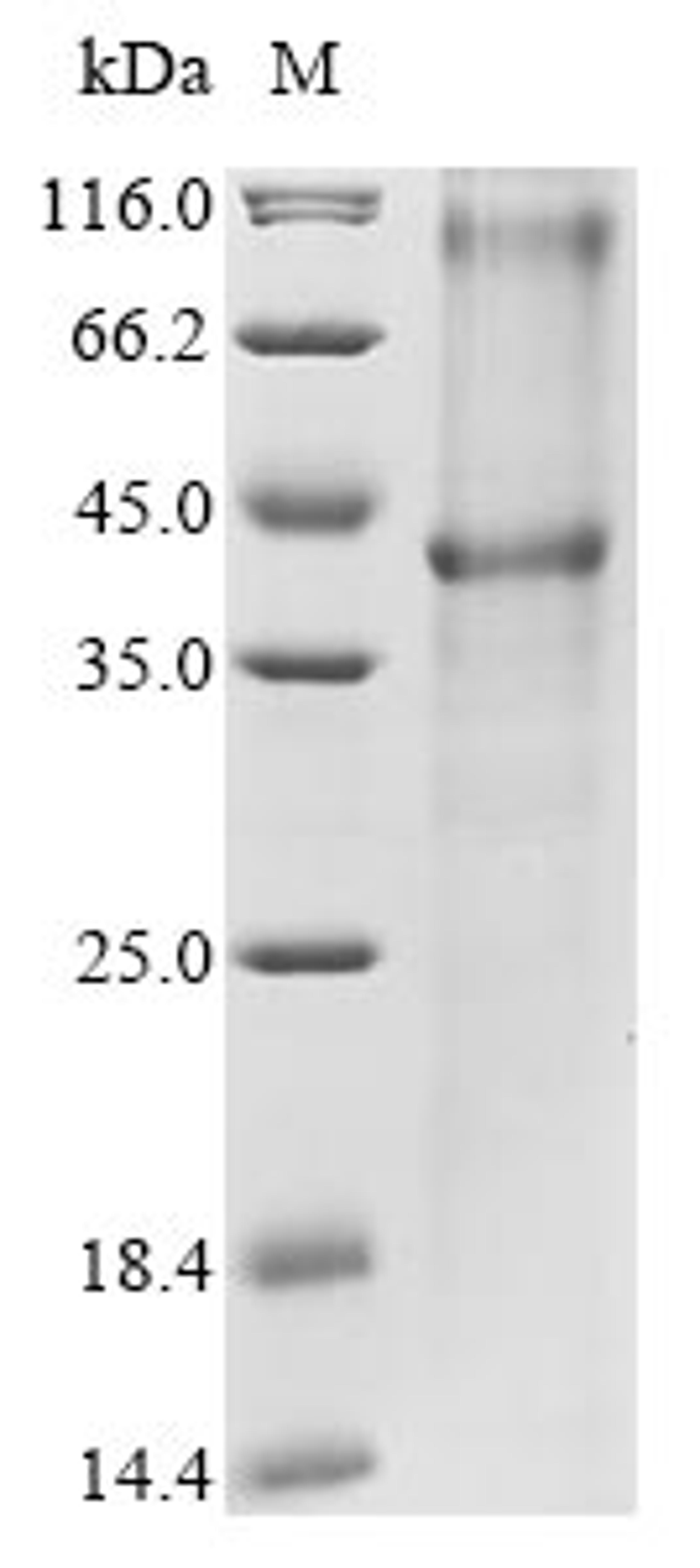 (Tris-Glycine gel) Discontinuous SDS-PAGE (reduced) with 5% enrichment gel and 15% separation gel.
