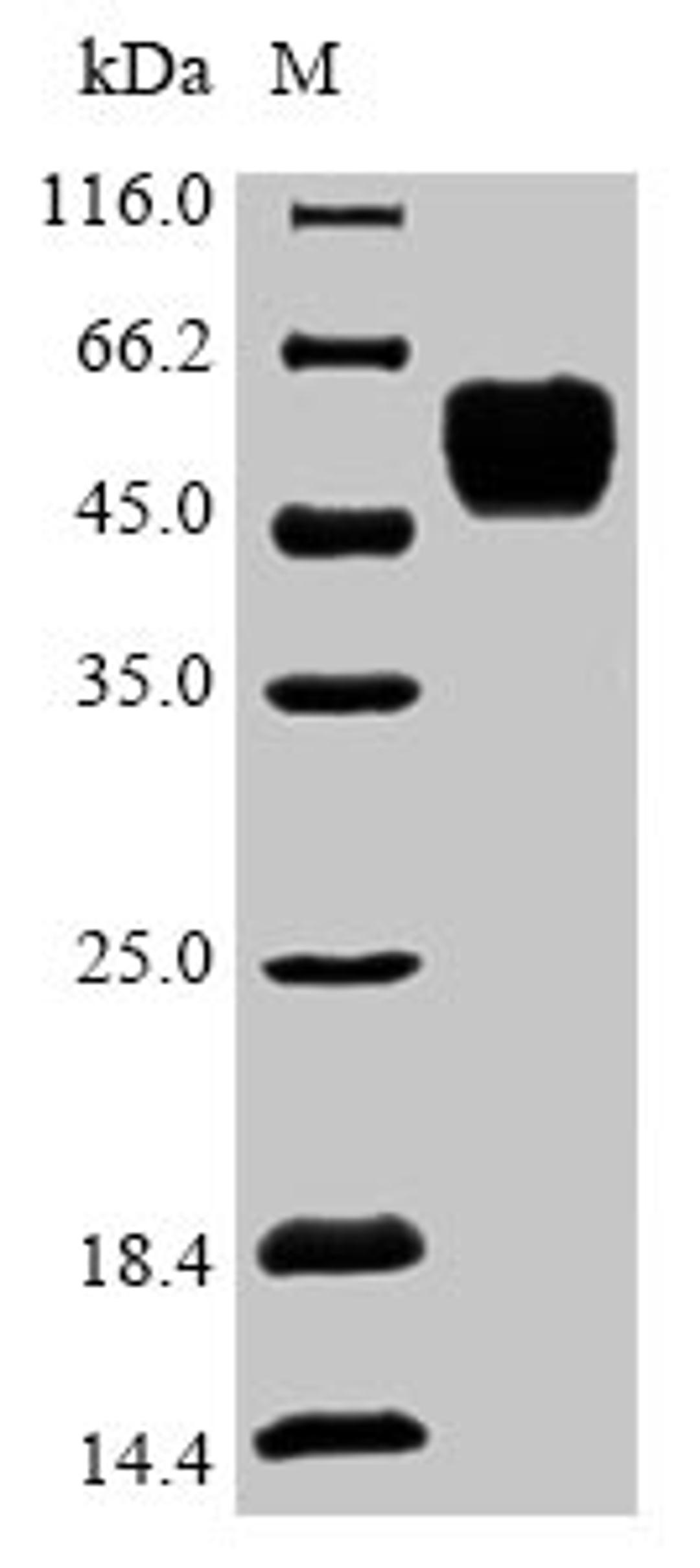 (Tris-Glycine gel) Discontinuous SDS-PAGE (reduced) with 5% enrichment gel and 15% separation gel.