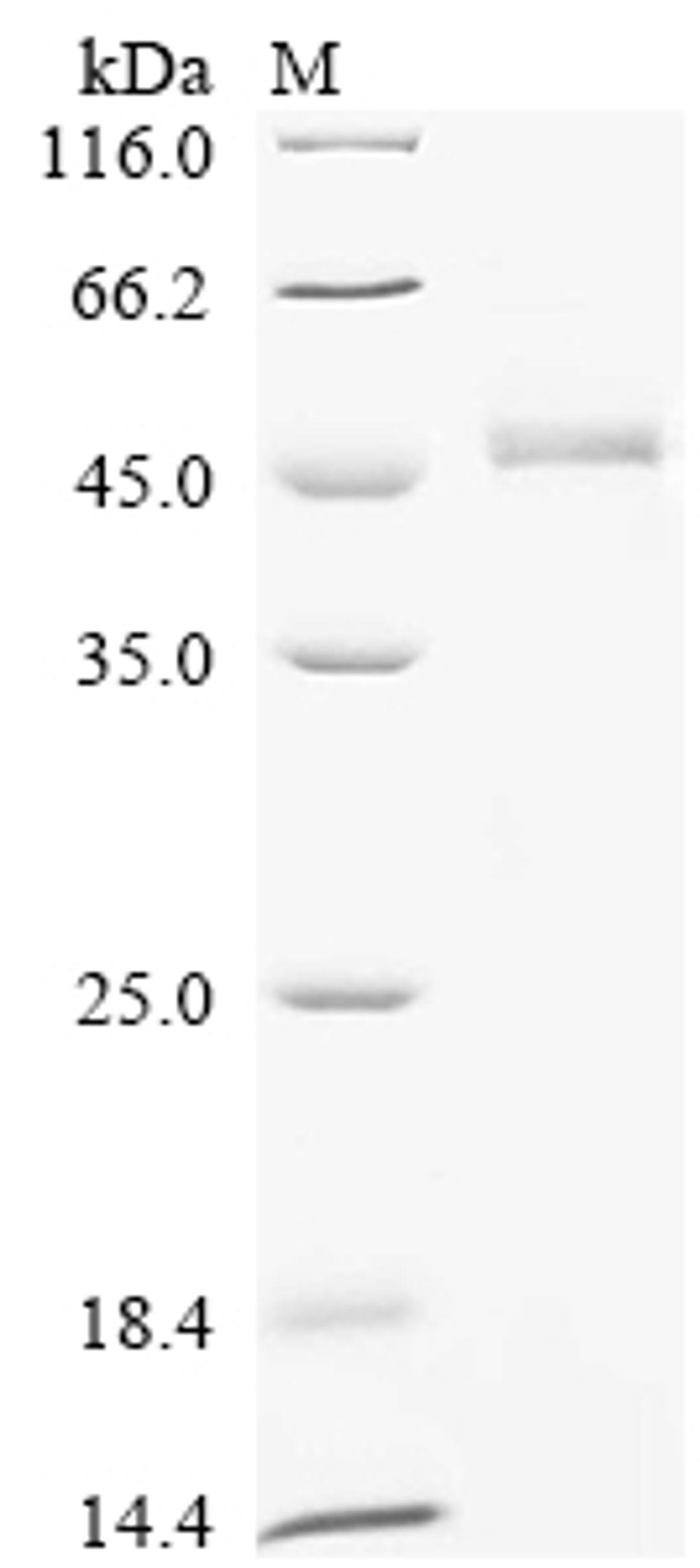 (Tris-Glycine gel) Discontinuous SDS-PAGE (reduced) with 5% enrichment gel and 15% separation gel.