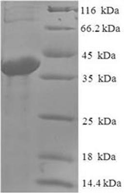 (Tris-Glycine gel) Discontinuous SDS-PAGE (reduced) with 5% enrichment gel and 15% separation gel.