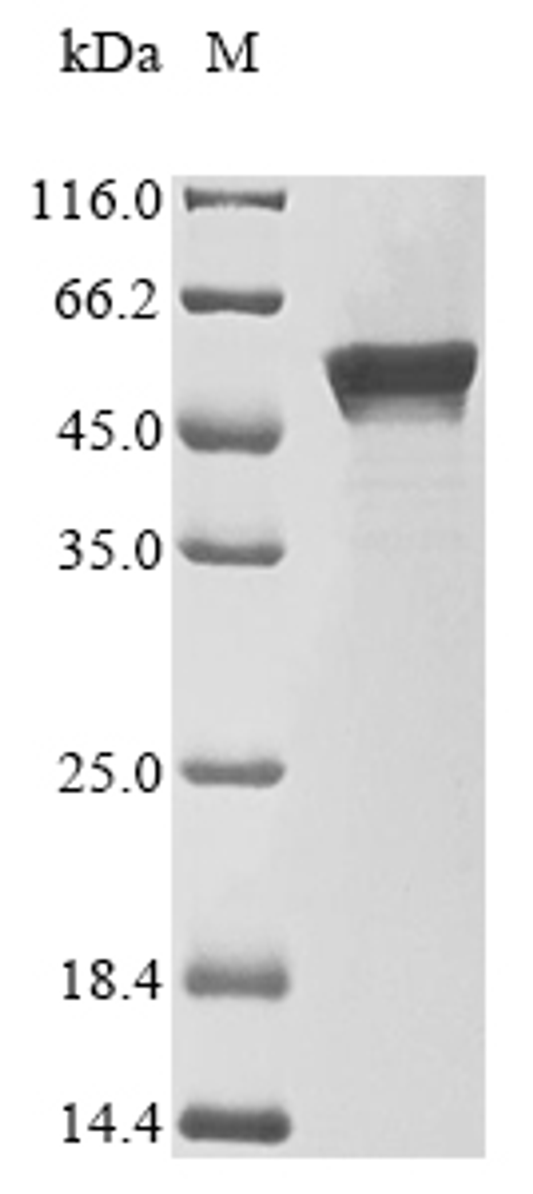 (Tris-Glycine gel) Discontinuous SDS-PAGE (reduced) with 5% enrichment gel and 15% separation gel.