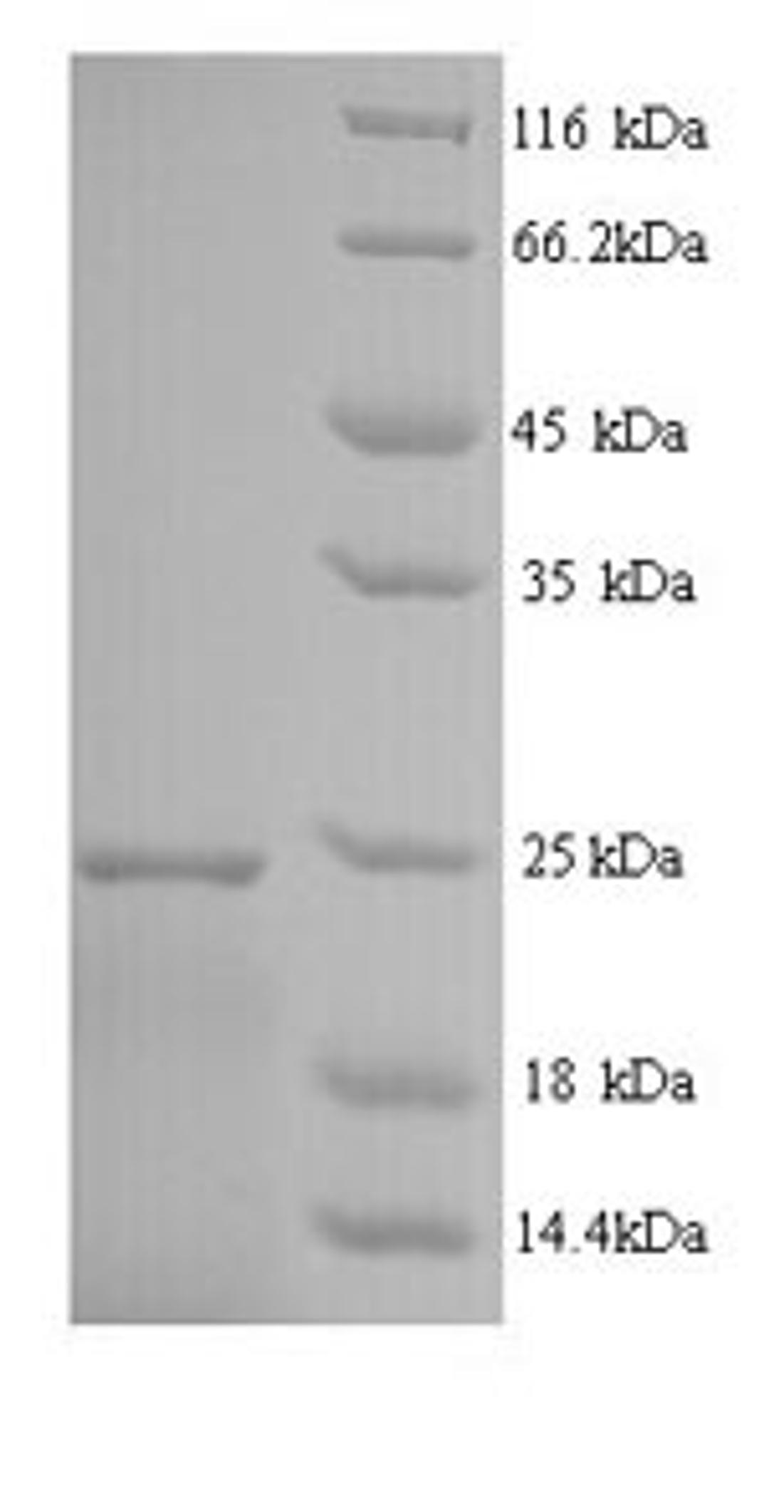 (Tris-Glycine gel) Discontinuous SDS-PAGE (reduced) with 5% enrichment gel and 15% separation gel.