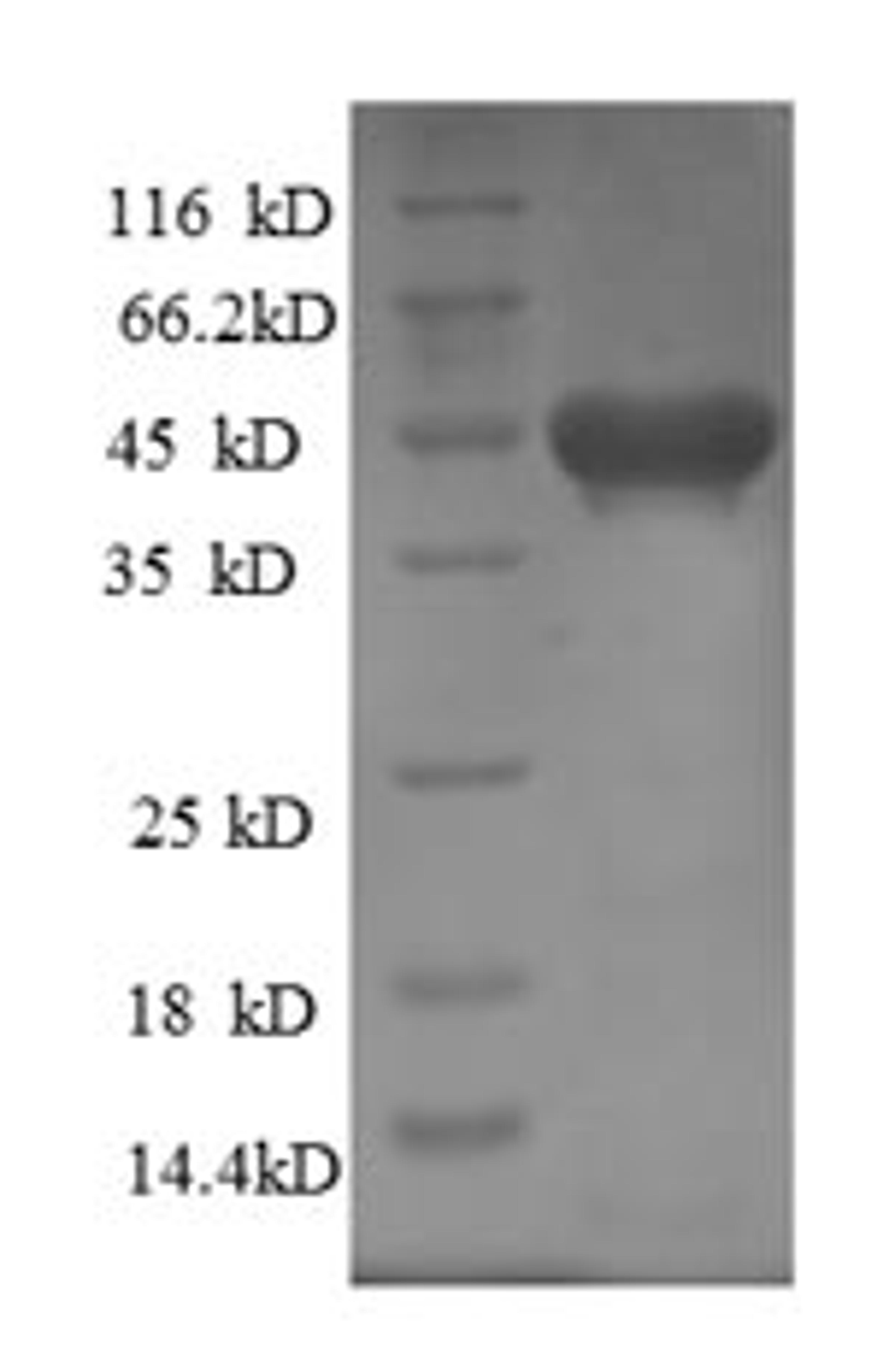 (Tris-Glycine gel) Discontinuous SDS-PAGE (reduced) with 5% enrichment gel and 15% separation gel.