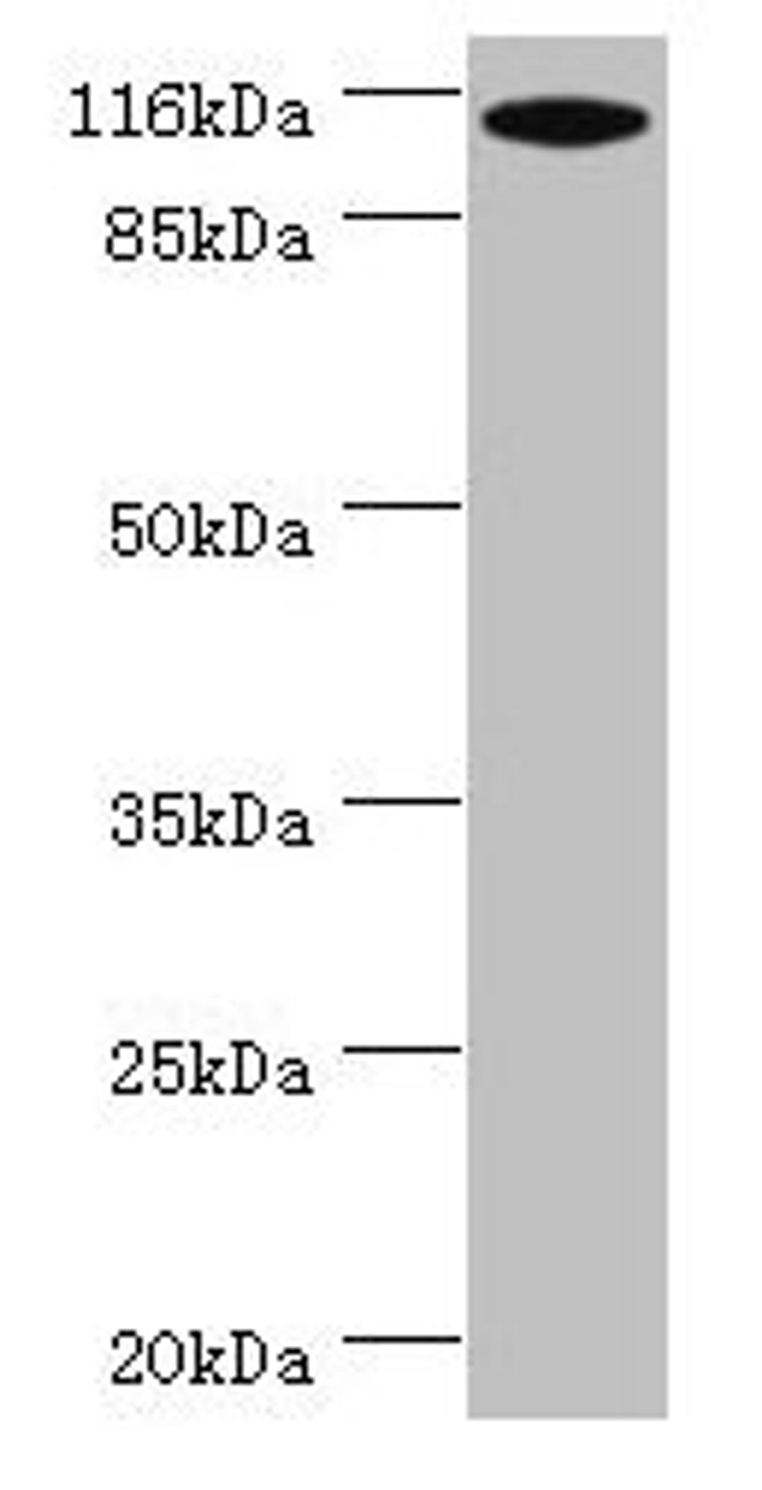 Western blot. All lanes: MYO19 antibody at 2µg/ml + A549 whole cell lysate. Secondary. Goat polyclonal to rabbit IgG at 1/10000 dilution. Predicted band size: 110, 36, 72, 87 kDa. Observed band size: 110 kDa