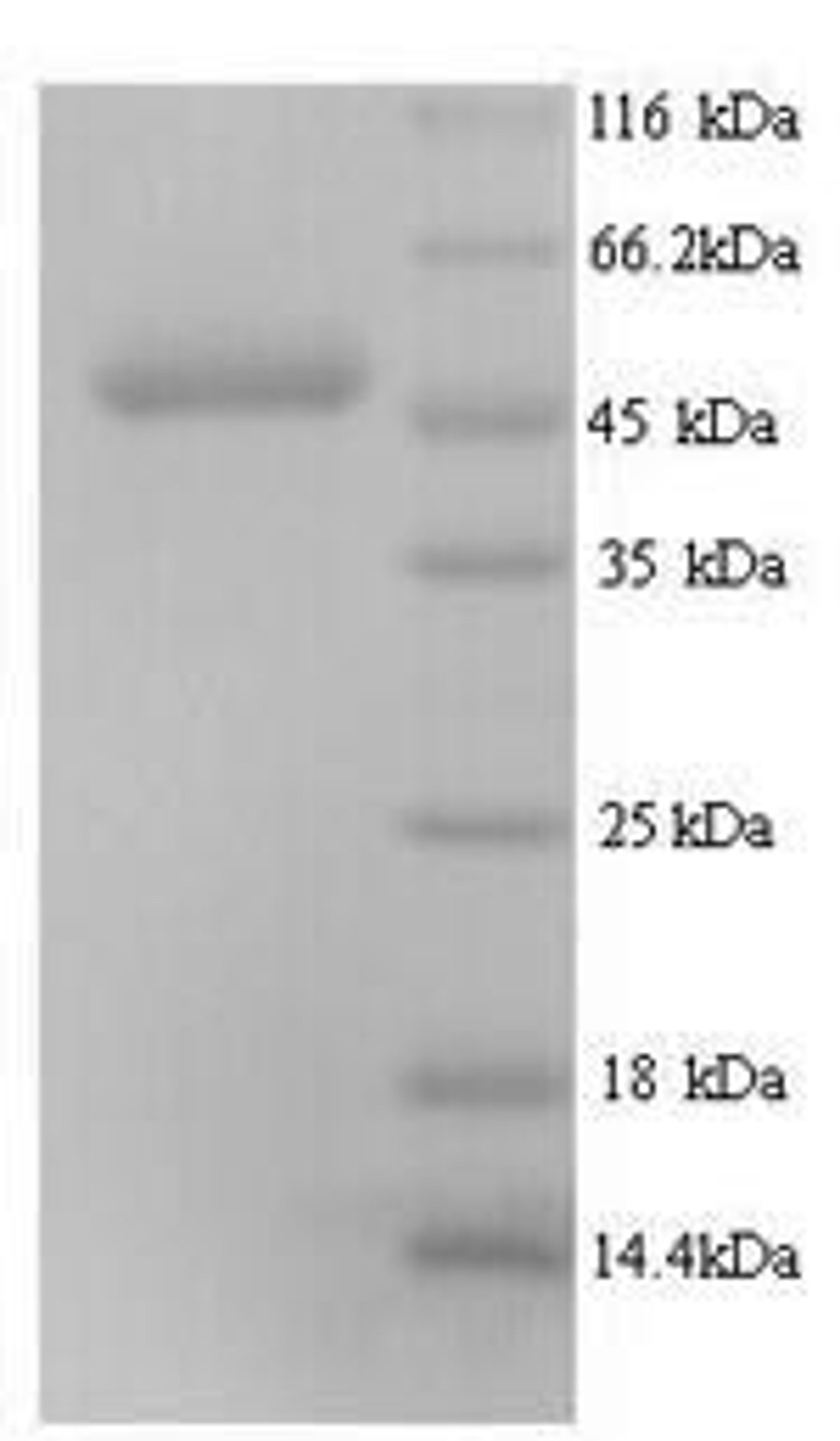 (Tris-Glycine gel) Discontinuous SDS-PAGE (reduced) with 5% enrichment gel and 15% separation gel.