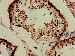 Immunohistochemistry of paraffin-embedded human testis tissue using CSB-PA812903LA01HU at dilution of 1:100