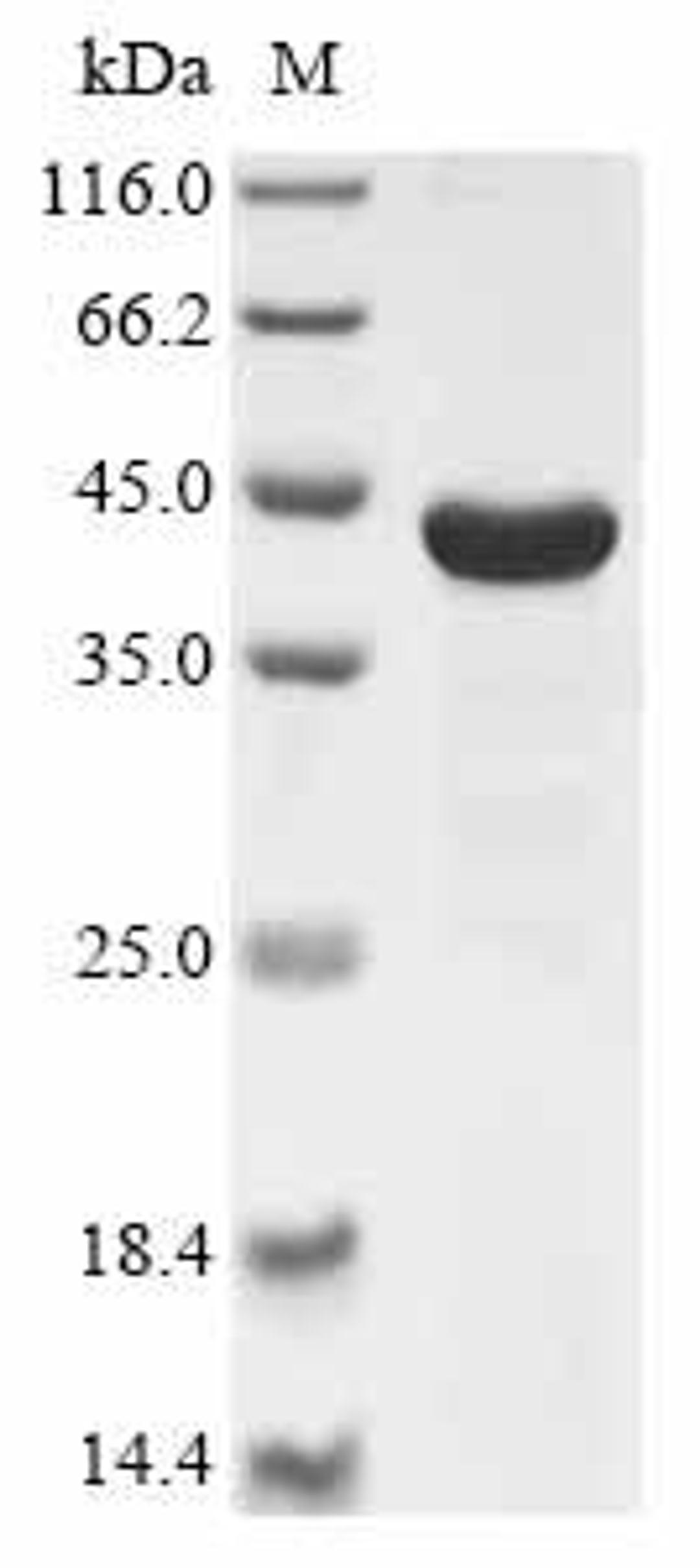 (Tris-Glycine gel) Discontinuous SDS-PAGE (reduced) with 5% enrichment gel and 15% separation gel.