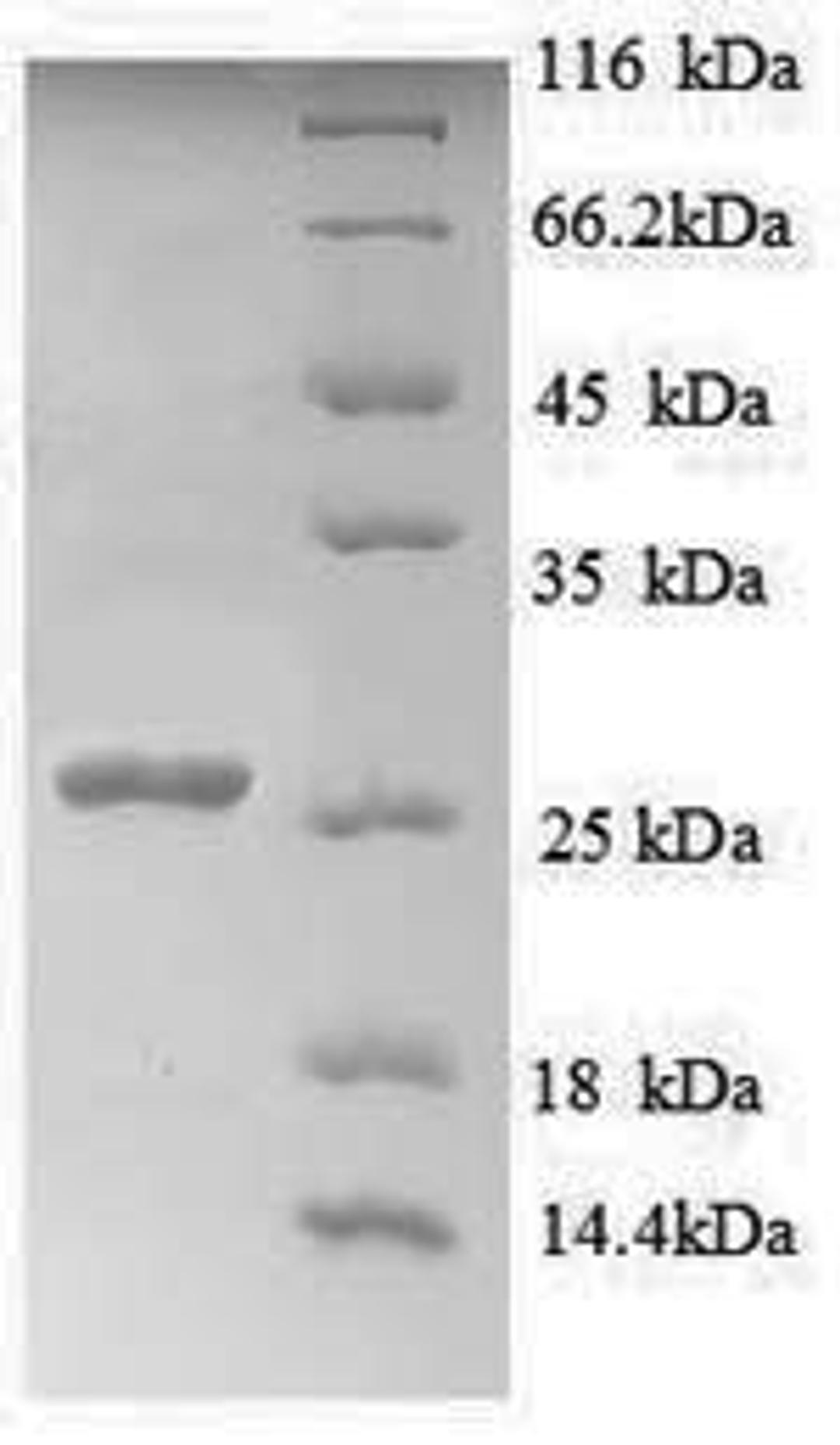 (Tris-Glycine gel) Discontinuous SDS-PAGE (reduced) with 5% enrichment gel and 15% separation gel.