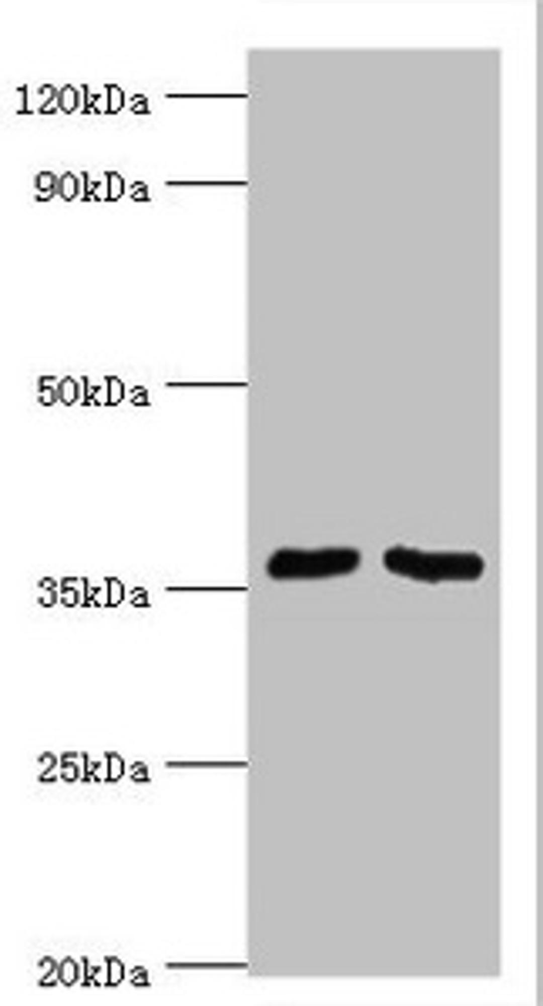 Western blot. All lanes: Methylosome protein 50 antibody at 6ug/ml. Lane 1: Hela whole cell lysate. Lane 2: HepG2 whole cell lysate. Secondary. Goat polyclonal to rabbit IgG at 1/10000 dilution. Predicted band size: 37, 30 kDa. Observed band size: 37 kDa. 