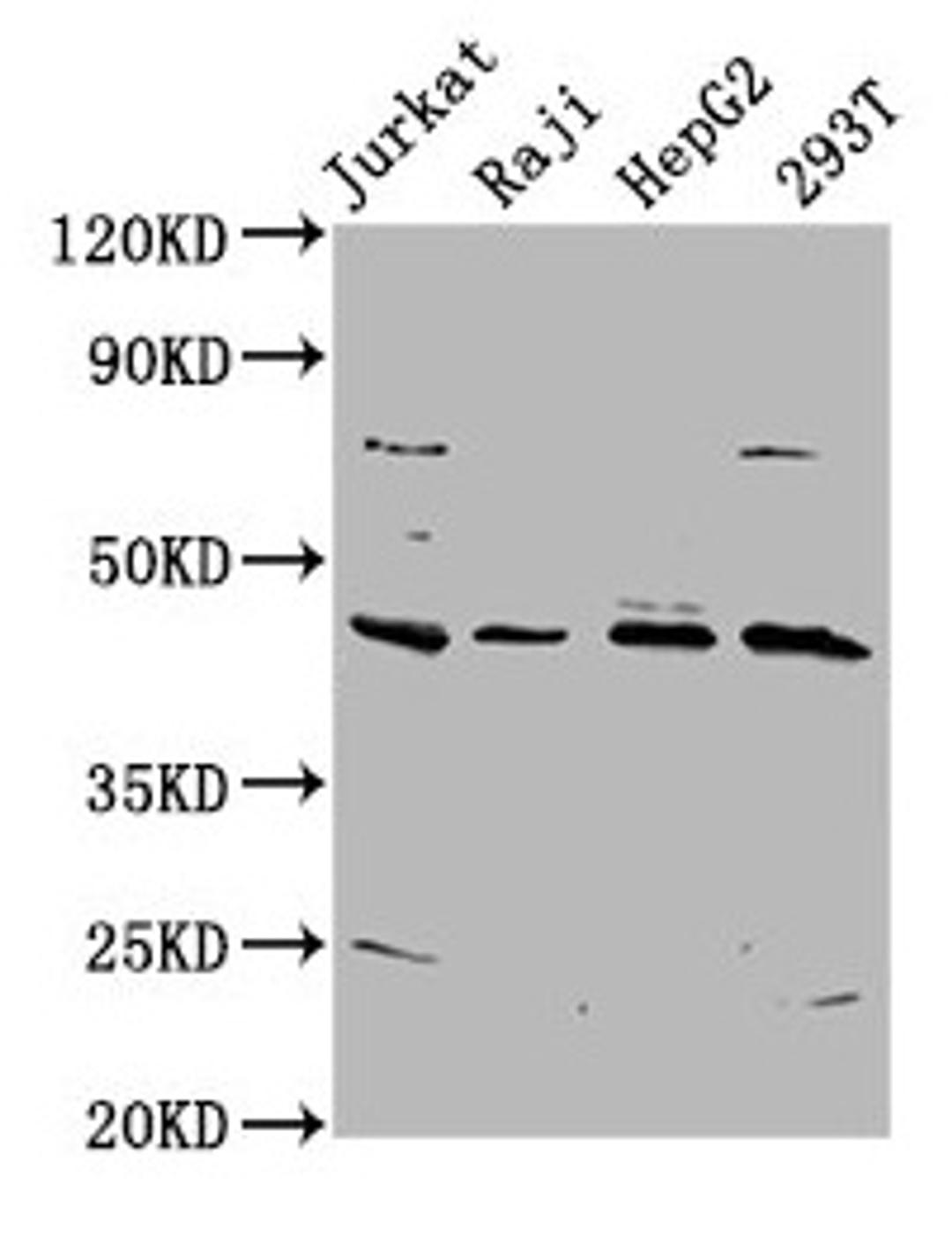 Western Blot. Positive WB detected in: Jurkat whole cell lysate, Raji whole cell lysate, HepG2 whole cell lysate, 293T whole cell lysate. All lanes: SPO11 antibody at 5.8µg/ml. Secondary. Goat polyclonal to rabbit IgG at 1/50000 dilution. Predicted band size: 45, 41 kDa. Observed band size: 45 kDa