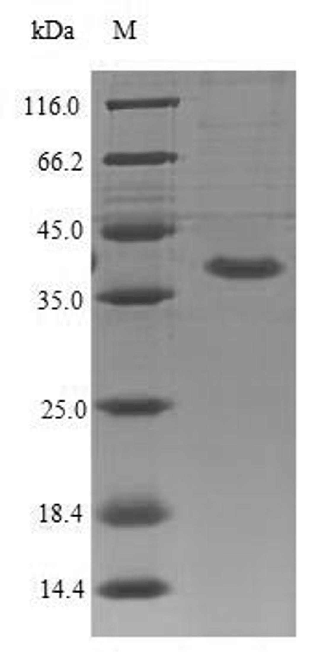 (Tris-Glycine gel) Discontinuous SDS-PAGE (reduced) with 5% enrichment gel and 15% separation gel.
