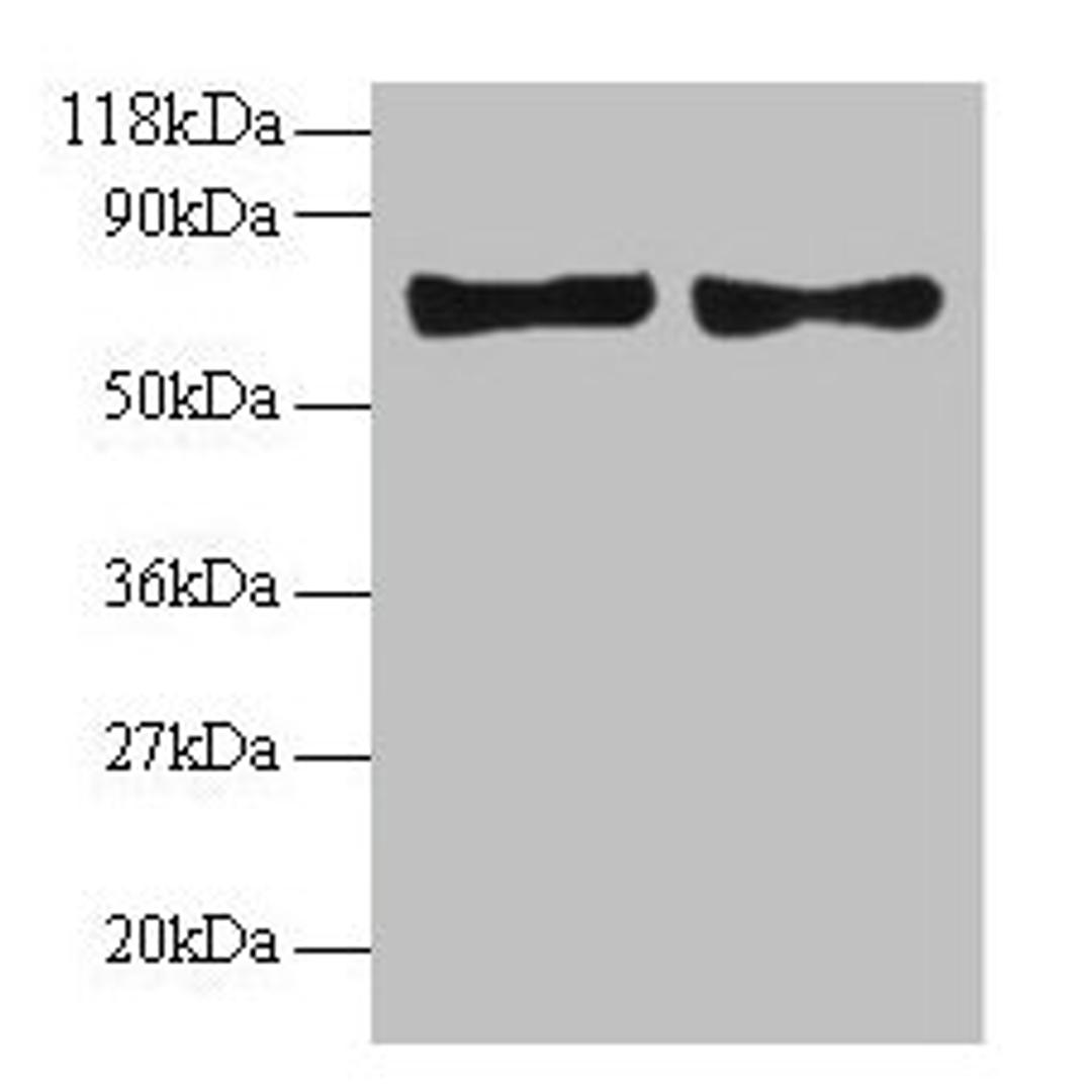 Western blot. All lanes: CCL5 antibody at 2µg/ml. Lane 1: EC109 whole cell lysate. Lane 2: 293T whole cell lysate. Secondary. Goat polyclonal to rabbit IgG at 1/15000 dilution. Predicted band size: 10 kDa. Observed band size: 70 kDa