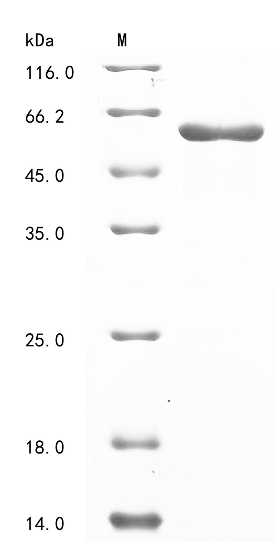 (Tris-Glycine gel) Discontinuous SDS-PAGE (reduced) with 5% enrichment gel and 15% separation gel.
