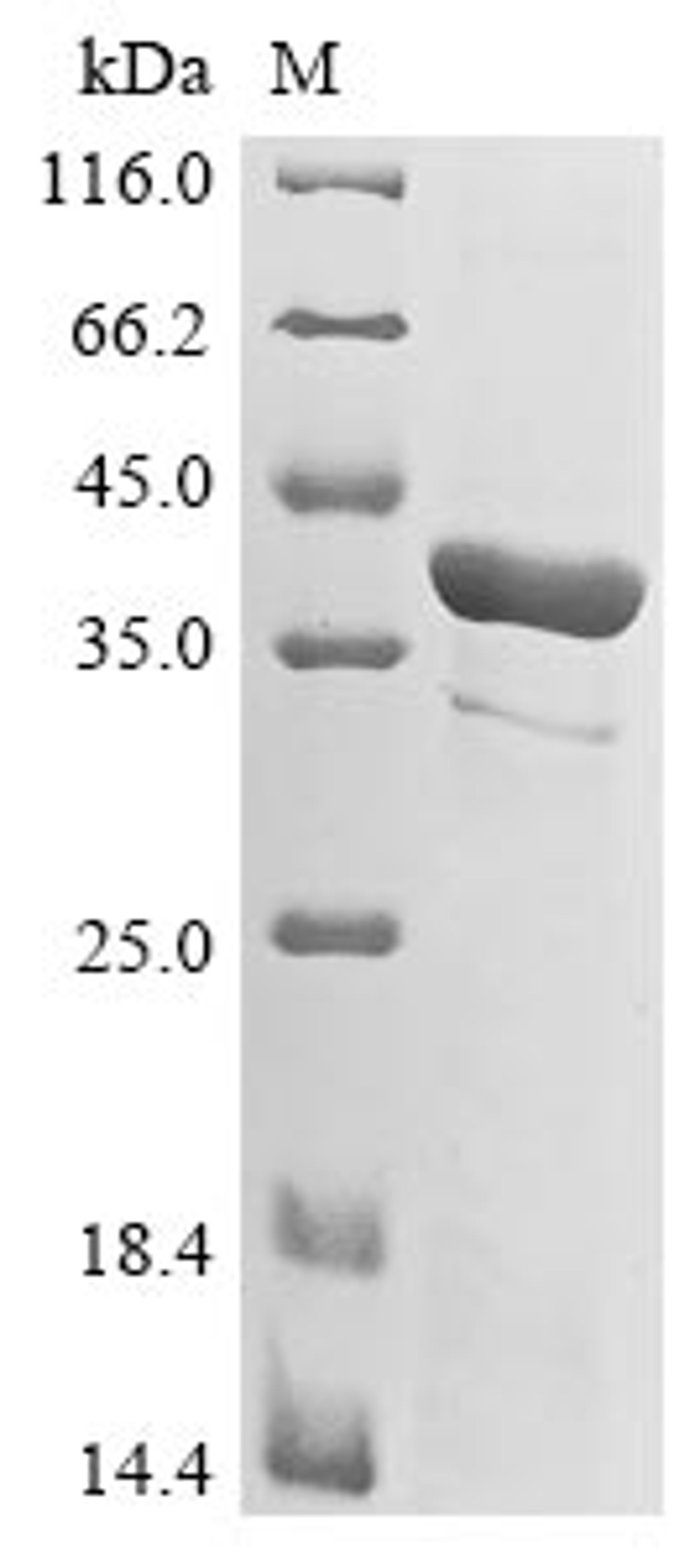 (Tris-Glycine gel) Discontinuous SDS-PAGE (reduced) with 5% enrichment gel and 15% separation gel.