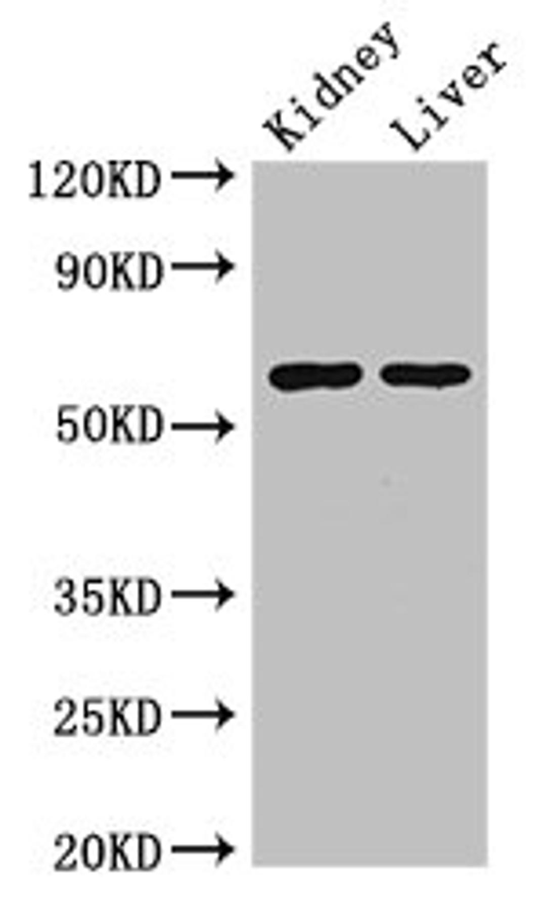 Western Blot. Positive WB detected in: Mouse kidney tissue, Mouse liver tissue. All lanes: ALDH6A1 antibody at 2.5ug/ml. Secondary. Goat polyclonal to rabbit IgG at 1/50000 dilution. Predicted band size: 58, 57 kDa. Observed band size: 58 kDa. 