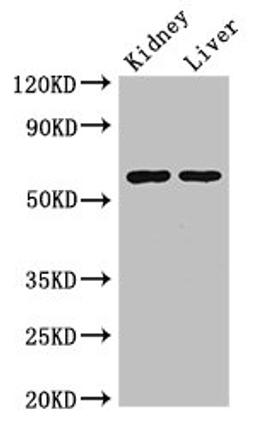 Western Blot. Positive WB detected in: Mouse kidney tissue, Mouse liver tissue. All lanes: ALDH6A1 antibody at 2.5ug/ml. Secondary. Goat polyclonal to rabbit IgG at 1/50000 dilution. Predicted band size: 58, 57 kDa. Observed band size: 58 kDa. 
