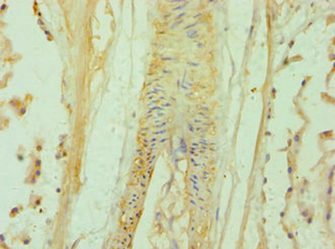 Immunohistochemistry of paraffin-embedded human prostate tissue using CSB-PA615666ESR2HU at dilution of 1:100