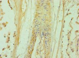Immunohistochemistry of paraffin-embedded human prostate tissue using CSB-PA615666ESR2HU at dilution of 1:100