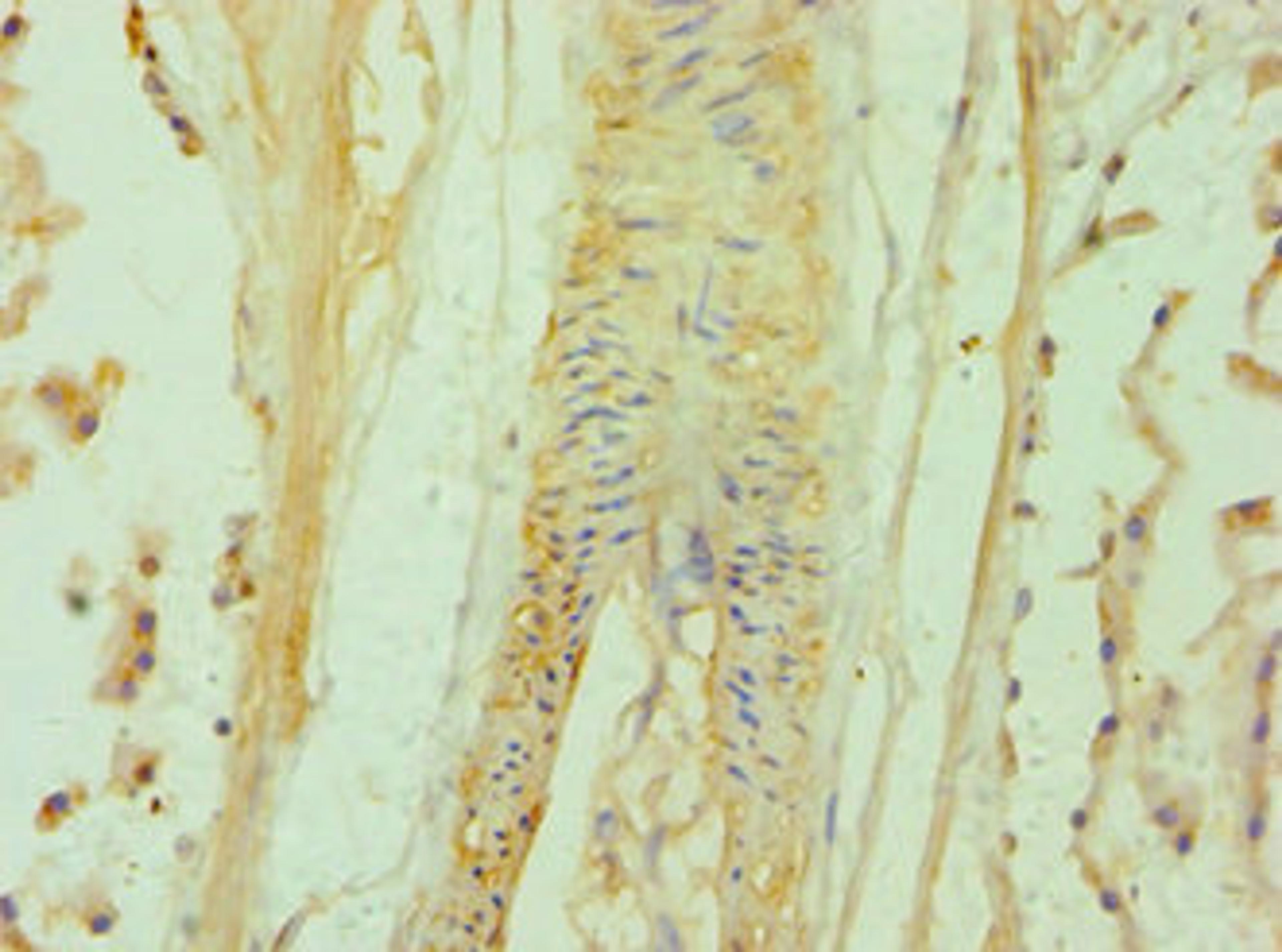 Immunohistochemistry of paraffin-embedded human prostate tissue using CSB-PA615666ESR2HU at dilution of 1:100