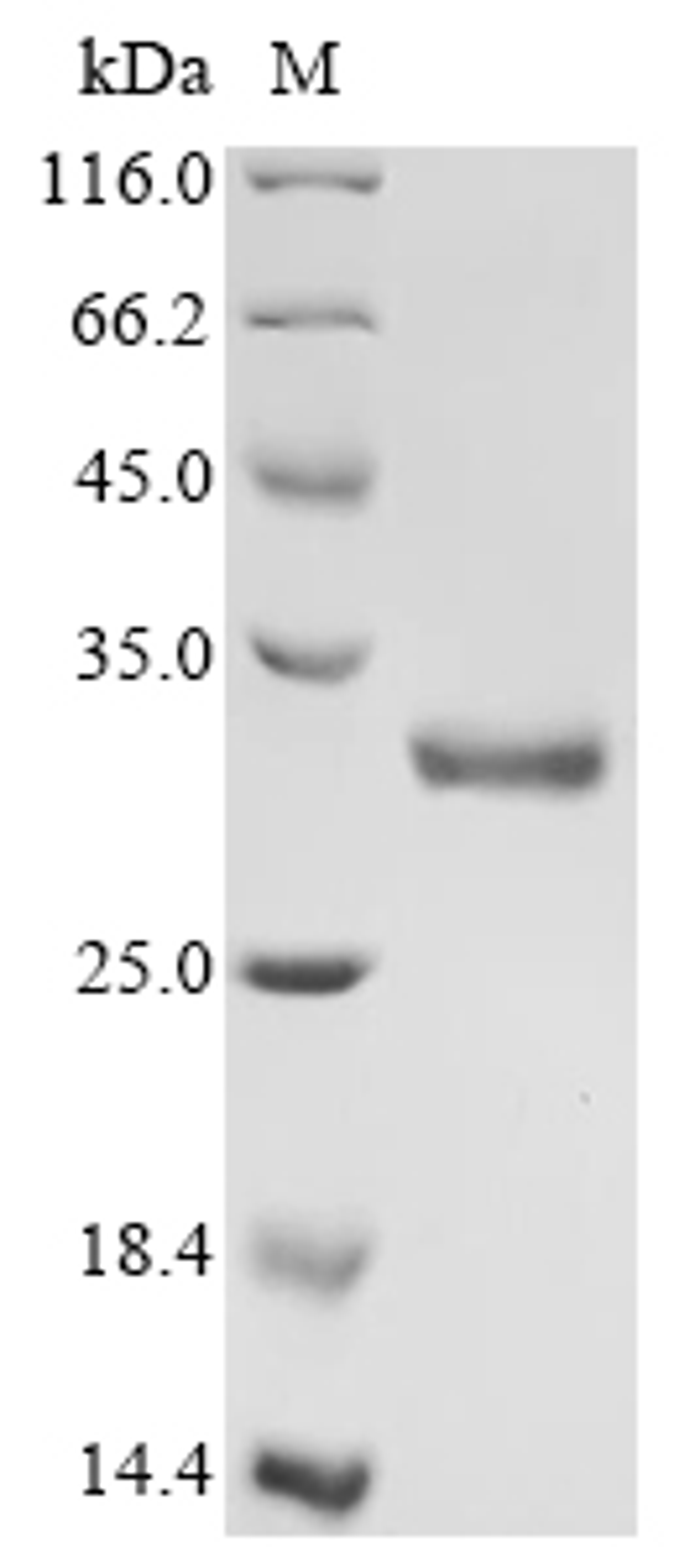 (Tris-Glycine gel) Discontinuous SDS-PAGE (reduced) with 5% enrichment gel and 15% separation gel.