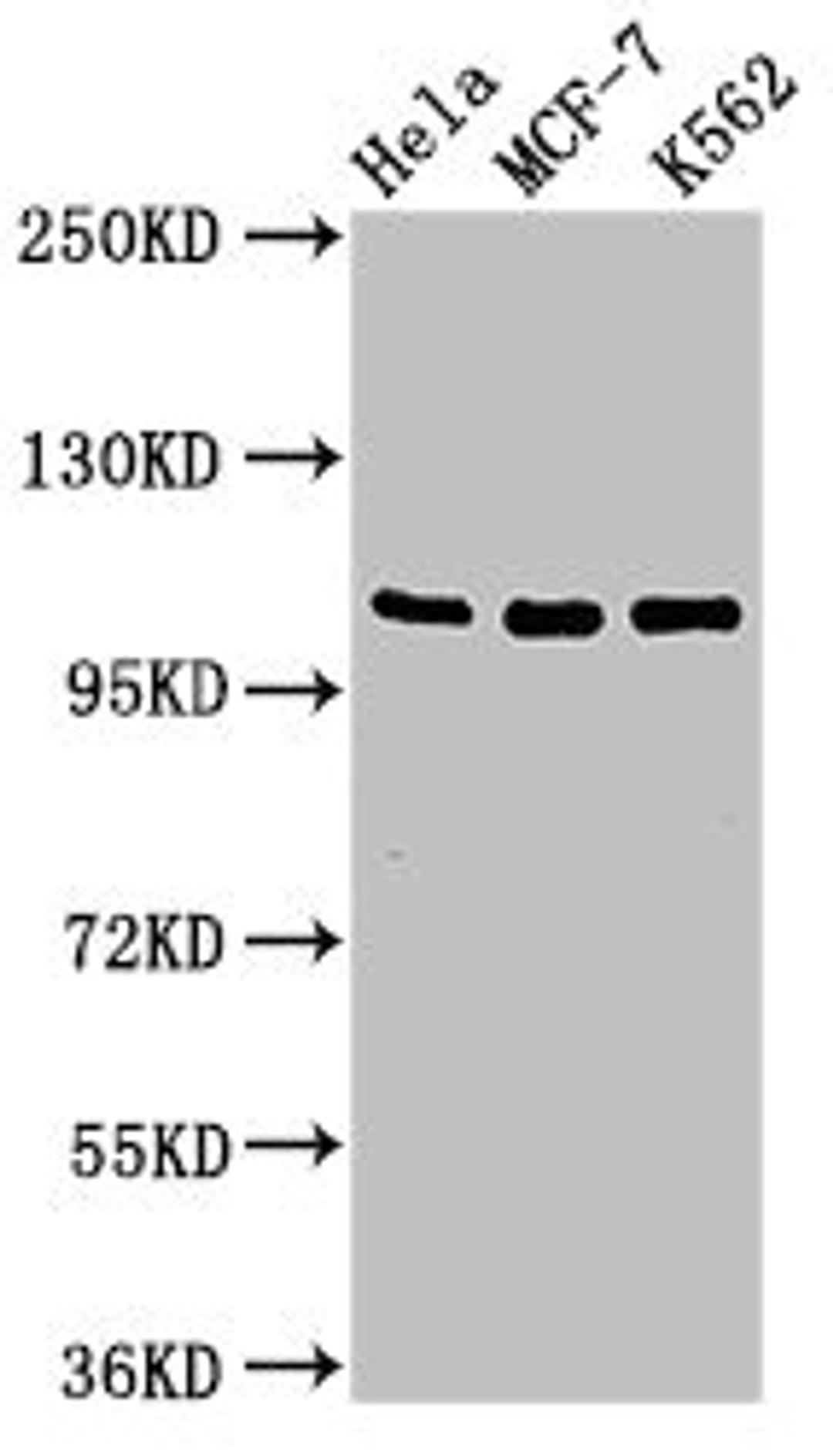 Western Blot. Positive WB detected in: Hela whole cell lysate, MCF-7 whole cell lysate, K562 whole cell lysate. All lanes: EVC antibody at 2ug/ml. Secondary. Goat polyclonal to rabbit IgG at 1/50000 dilution. Predicted band size: 112 kDa. Observed band size: 112 kDa. 