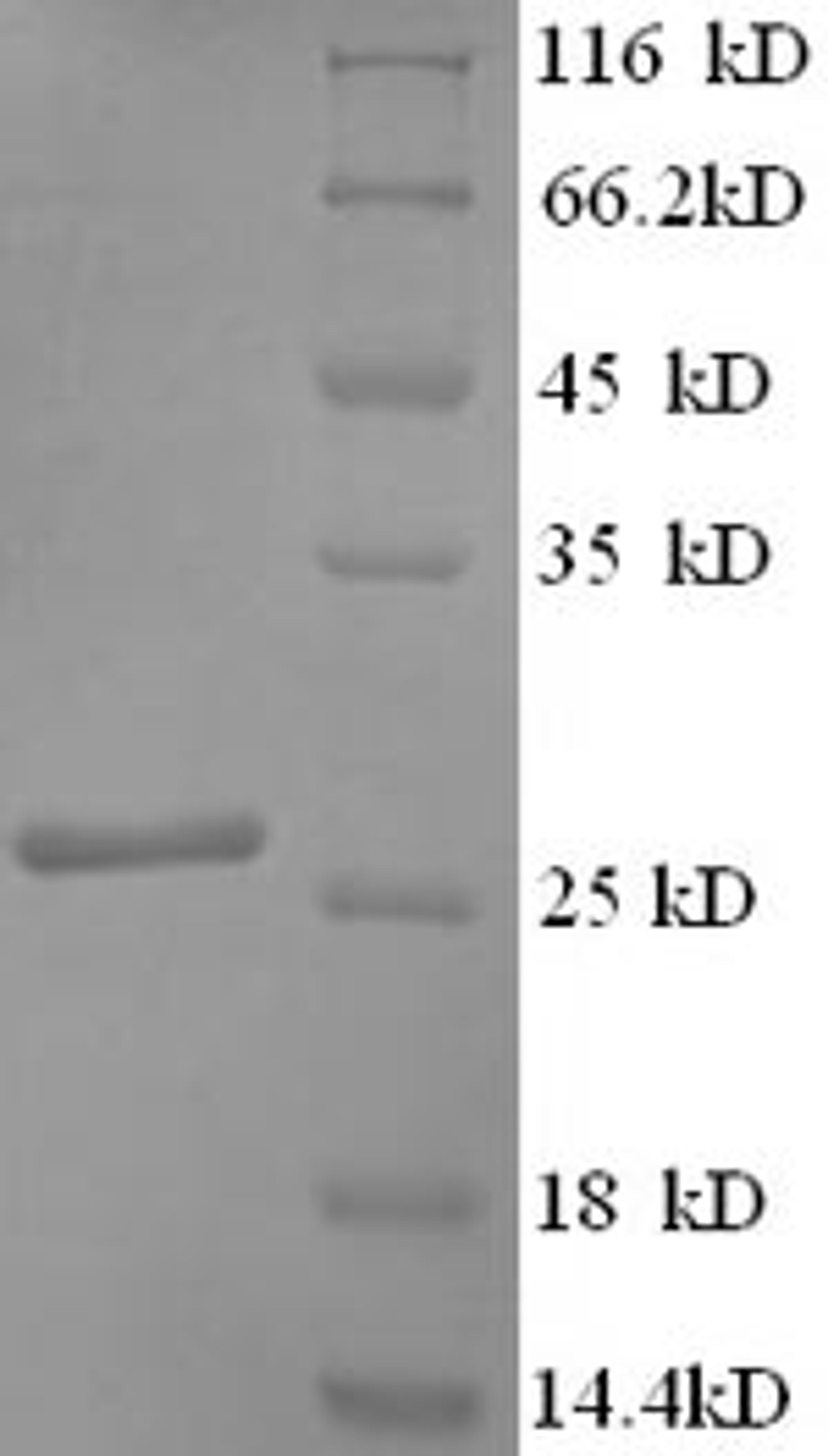 (Tris-Glycine gel) Discontinuous SDS-PAGE (reduced) with 5% enrichment gel and 15% separation gel.